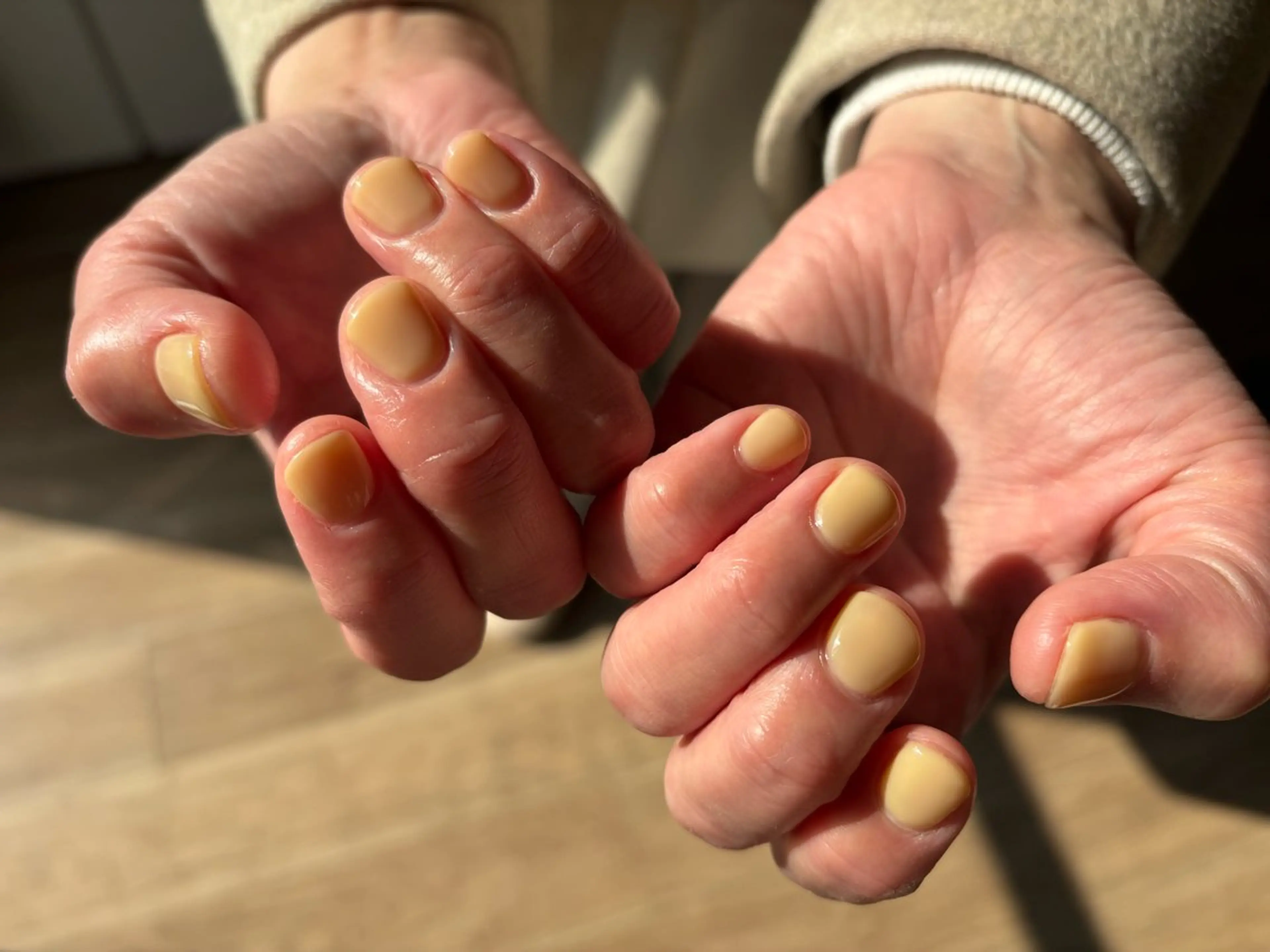 ネイル 黄色 ハンドネイル Solo nail -ソロネイル-のネイルデザイン