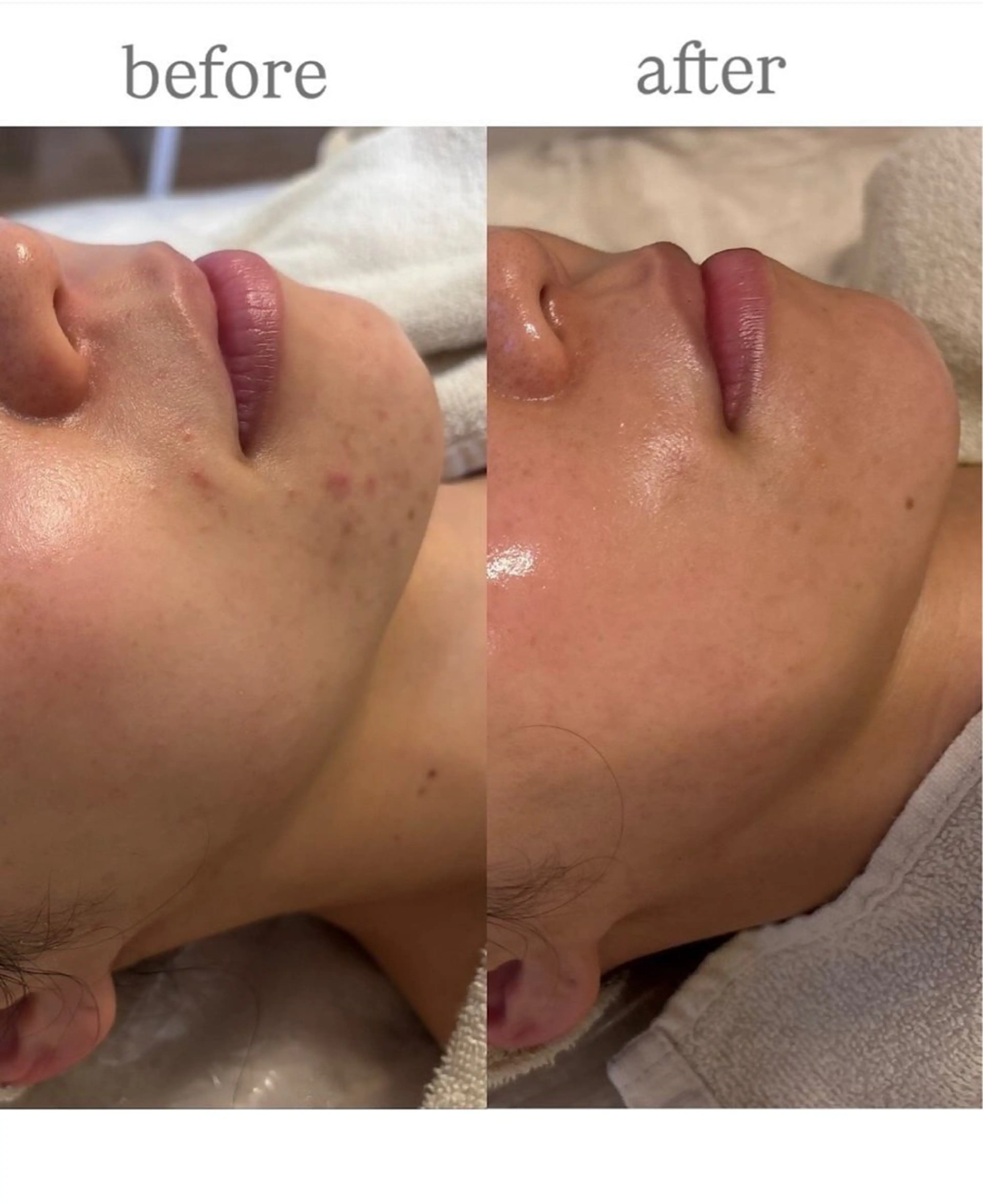 エステ anthes /MIHOのエステ・リラクイメージ