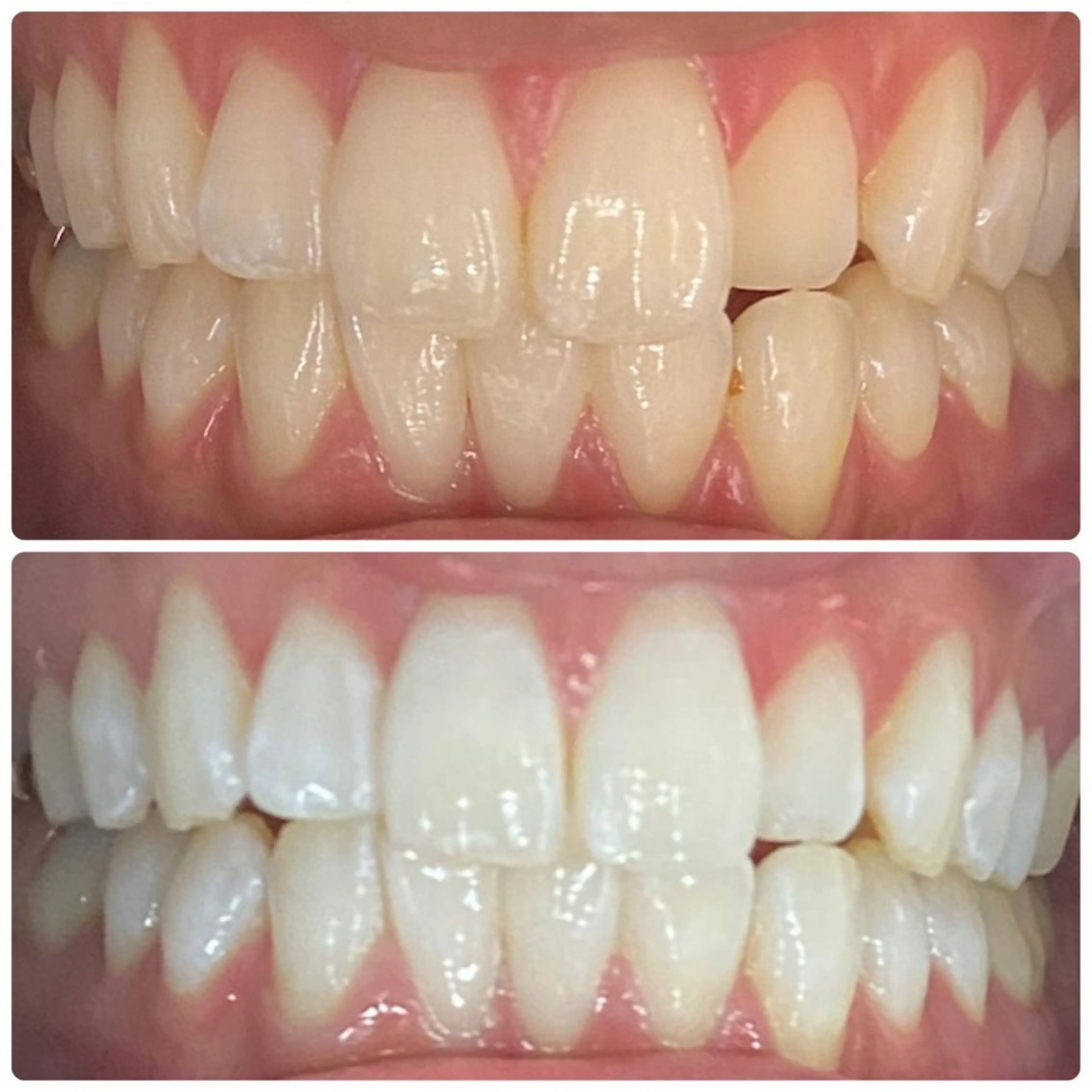 その他 ホワイトニング ルーム　川崎店のその他イメージ