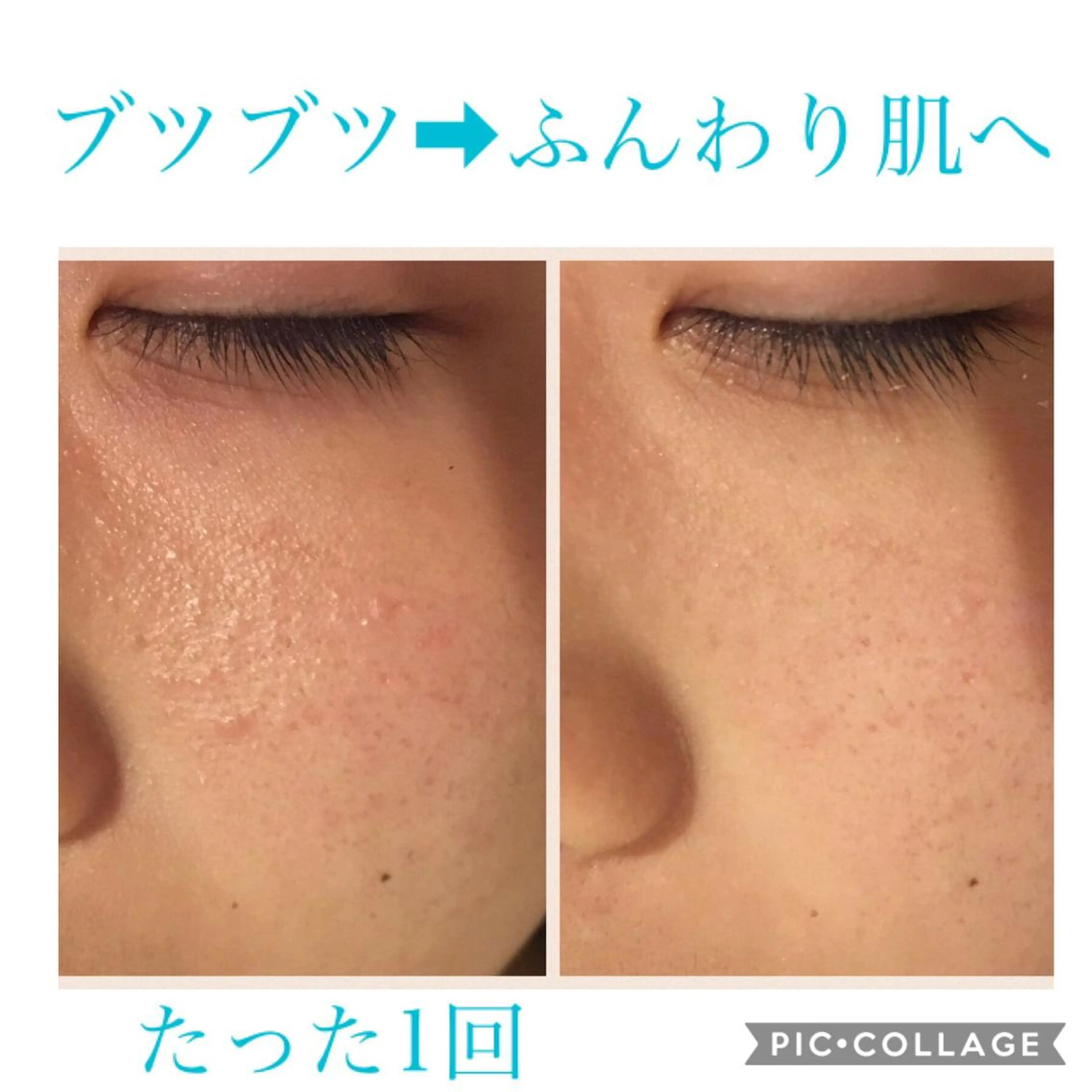 ミディアム カラー パーマ ヘアアレンジ キッズ ネイル マツエク・マツパ エステ リラク Ensor Clair所属・EnsorClair 代表 野口真央のエステ・リラクイメージ