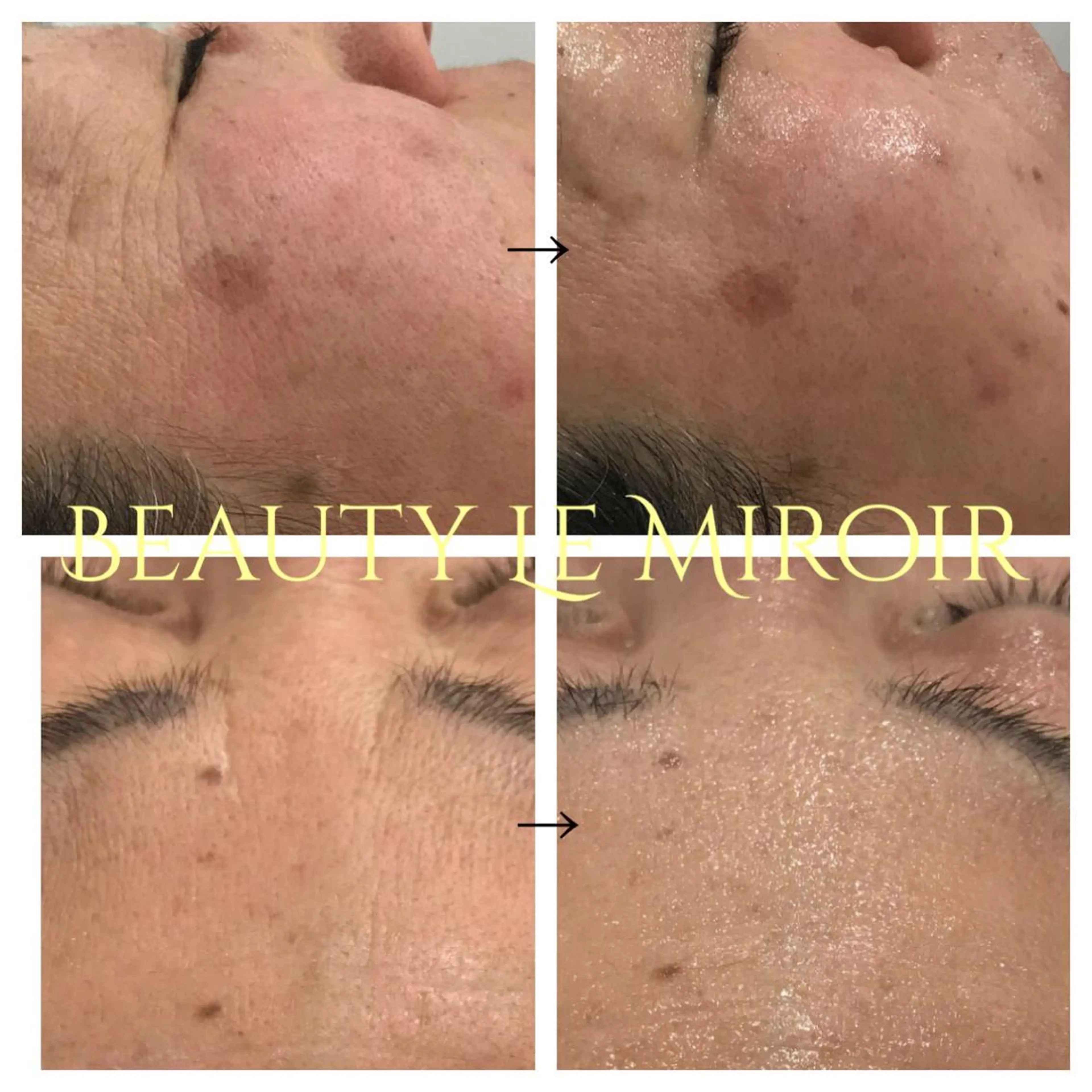 ビューティー ミロワールのエステ・リラクイメージ