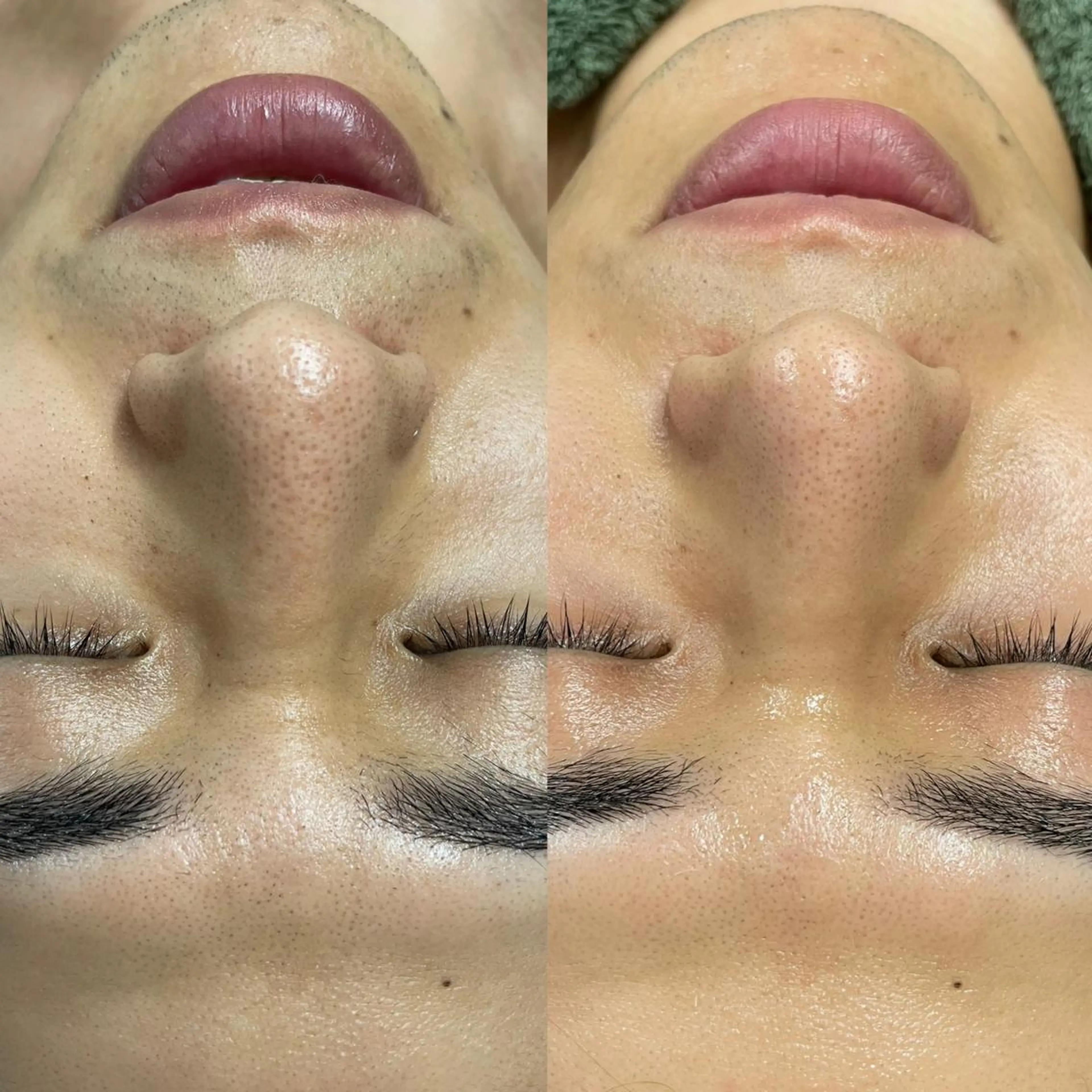 瑞穂区丸の内メナード 横山ともみのエステ・リラクイメージ