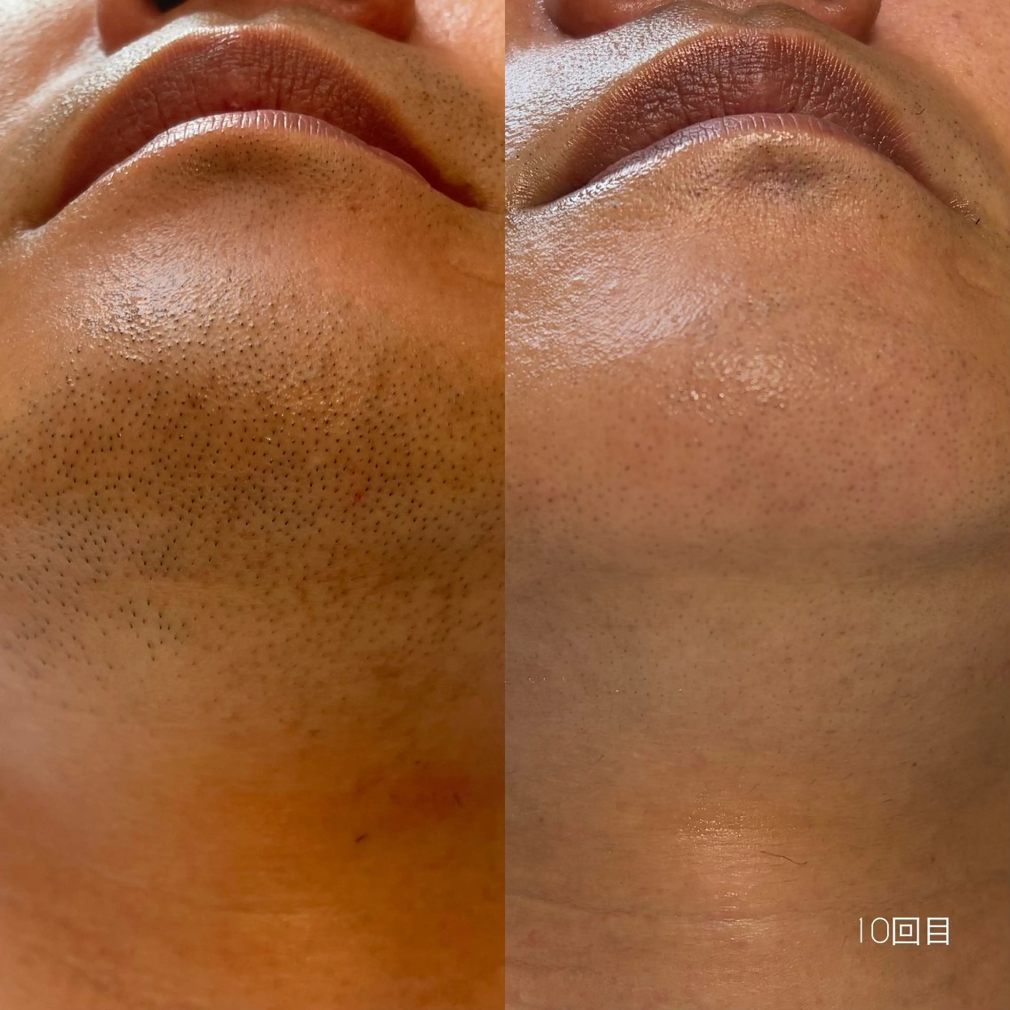 メンズ 脱毛 Lassy Yuriの眉毛・アイブロウイメージ