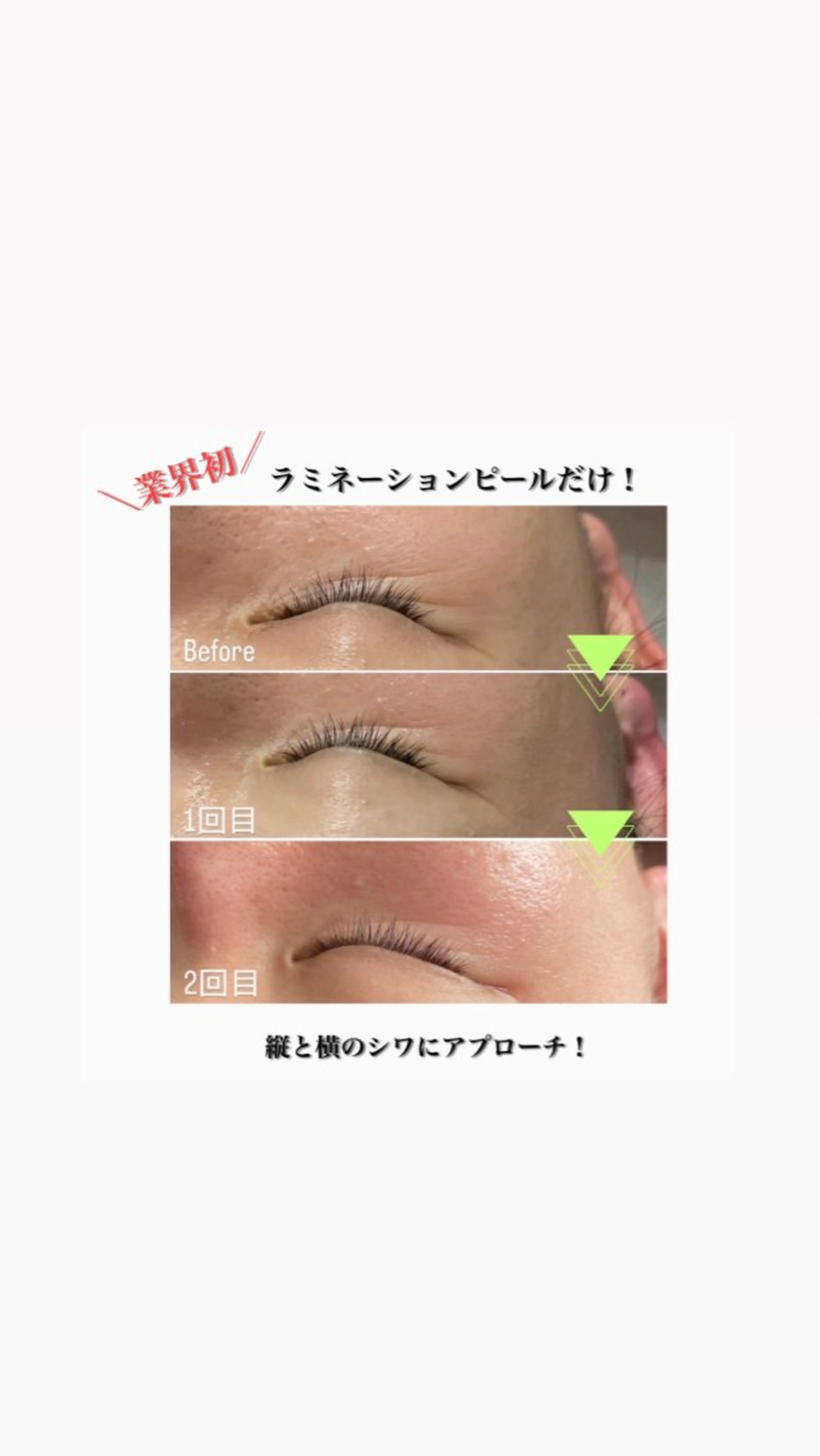 エステ beautysalon RAVIS所属・東大阪/韓国肌管理/ 痩身バスト専門店のエステ・リラクイメージ