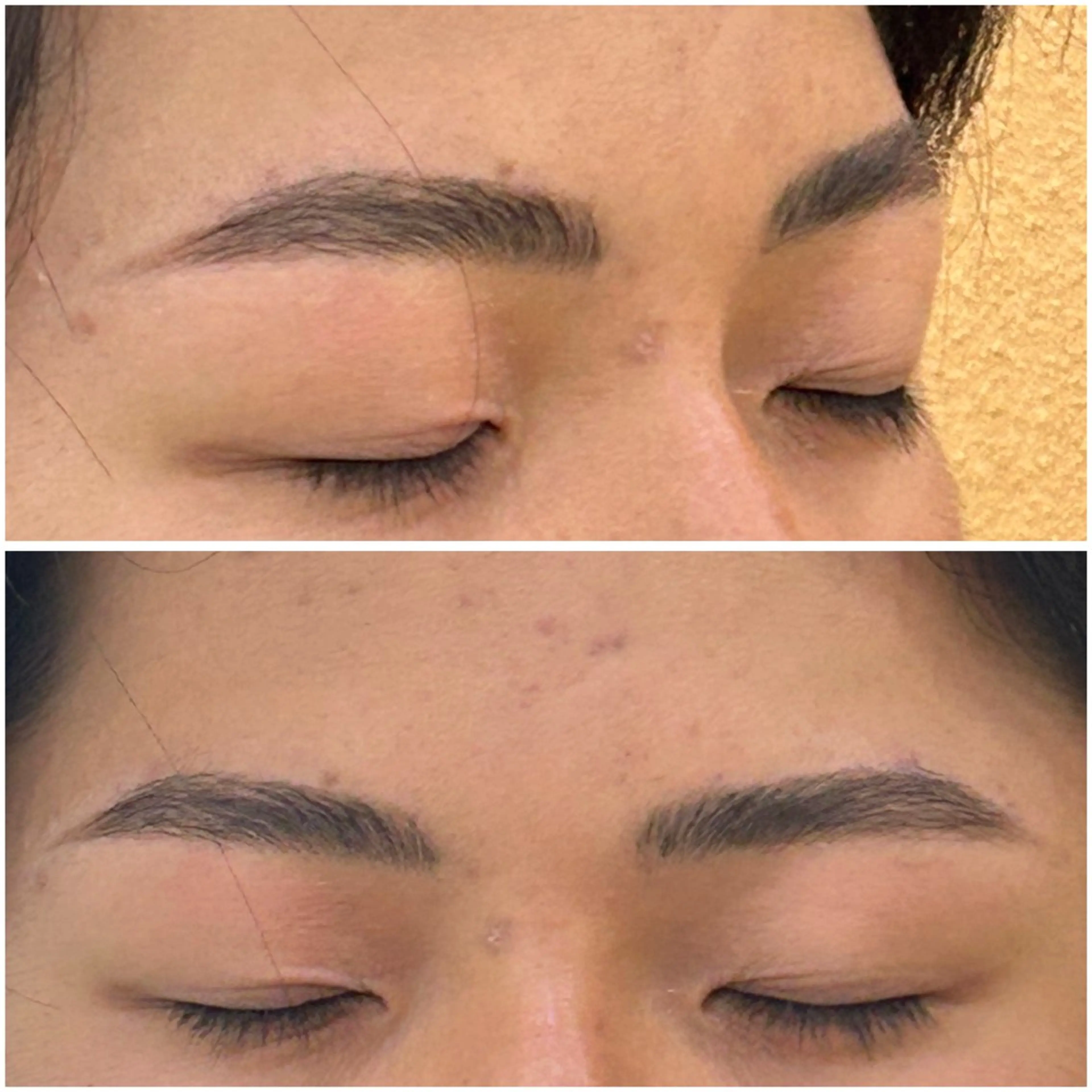 ワックス脱毛の写真