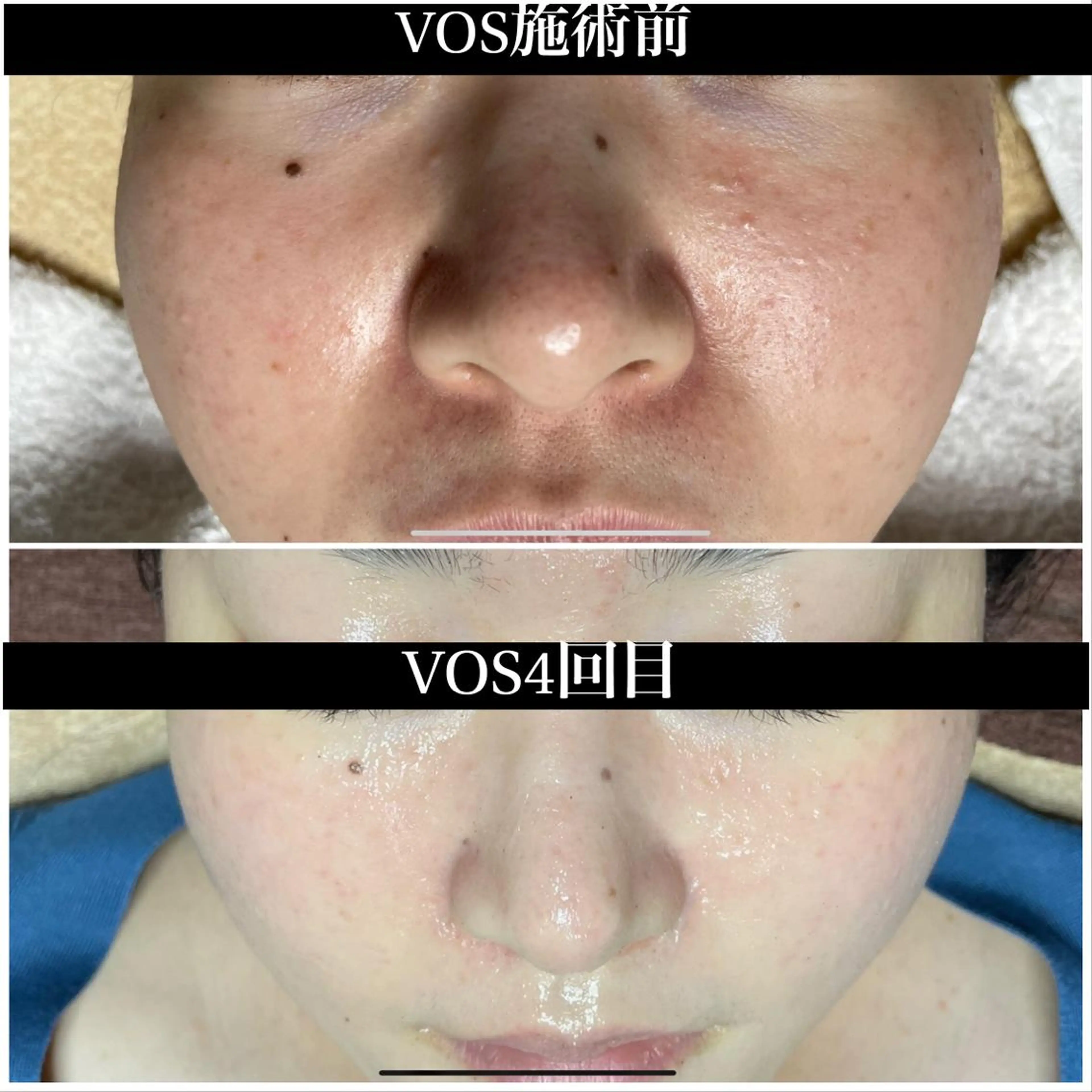 代表 MOMOのエステ・リラクイメージ