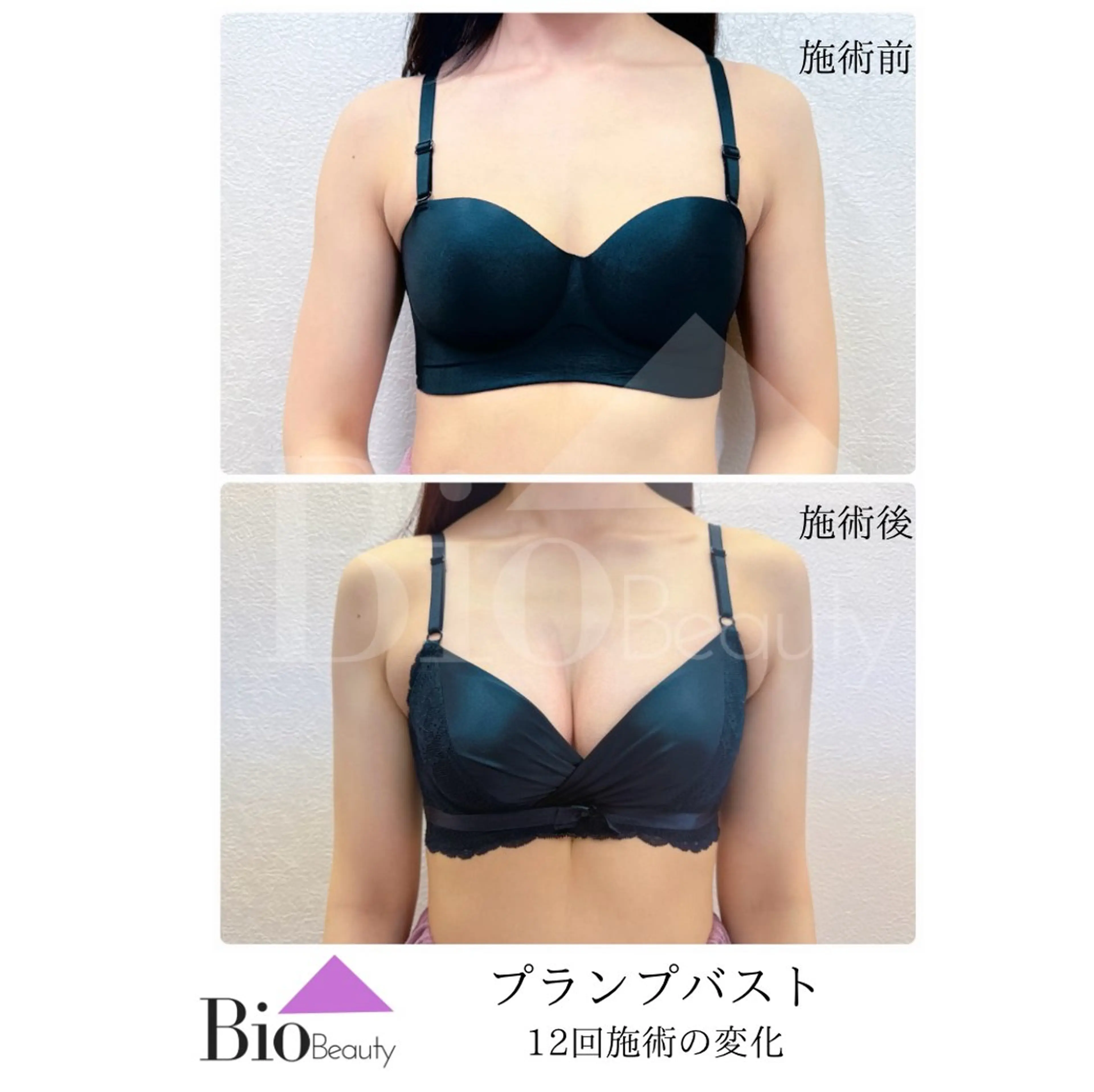 【初回体験】プランプバスト★全身ケアで理想の形・大きさを手に入れるの写真