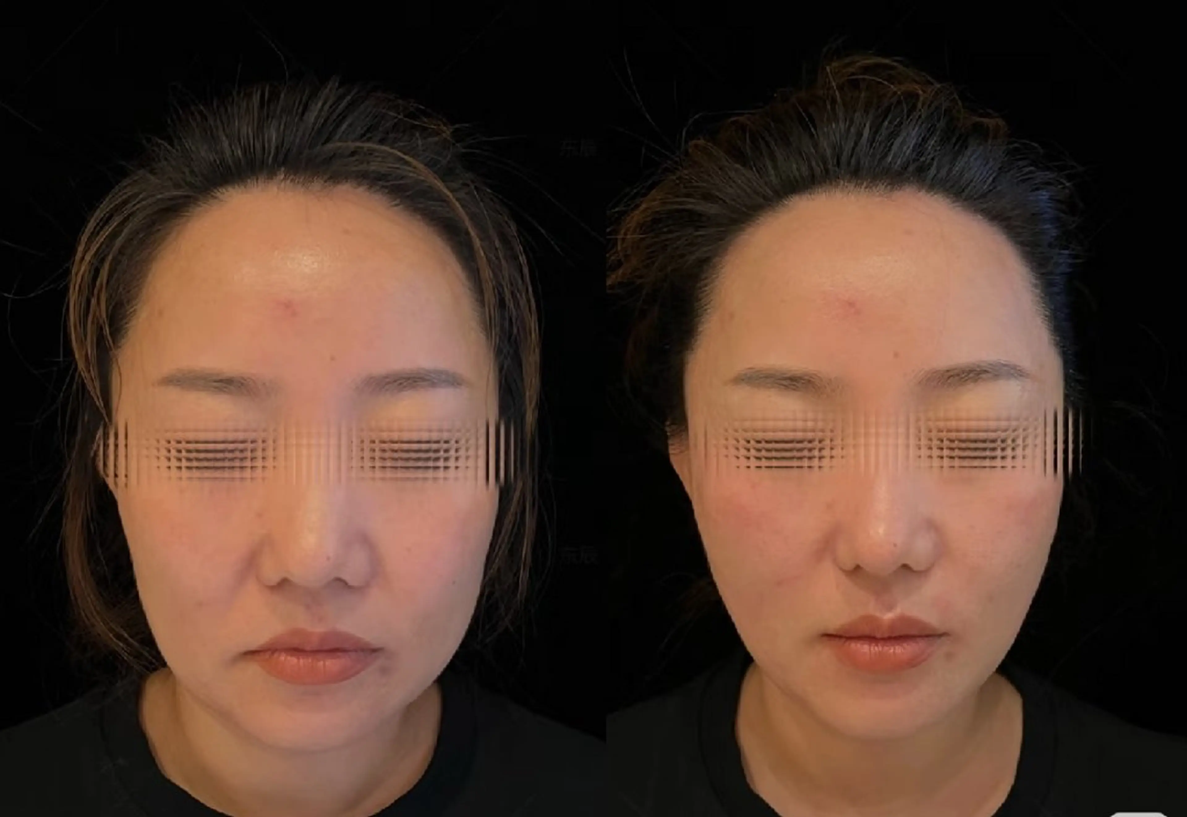 マツエク・マツパ 結婚式・ブライダル aliaハーブ水光店 エステティシャン募集のエステ・リラクイメージ