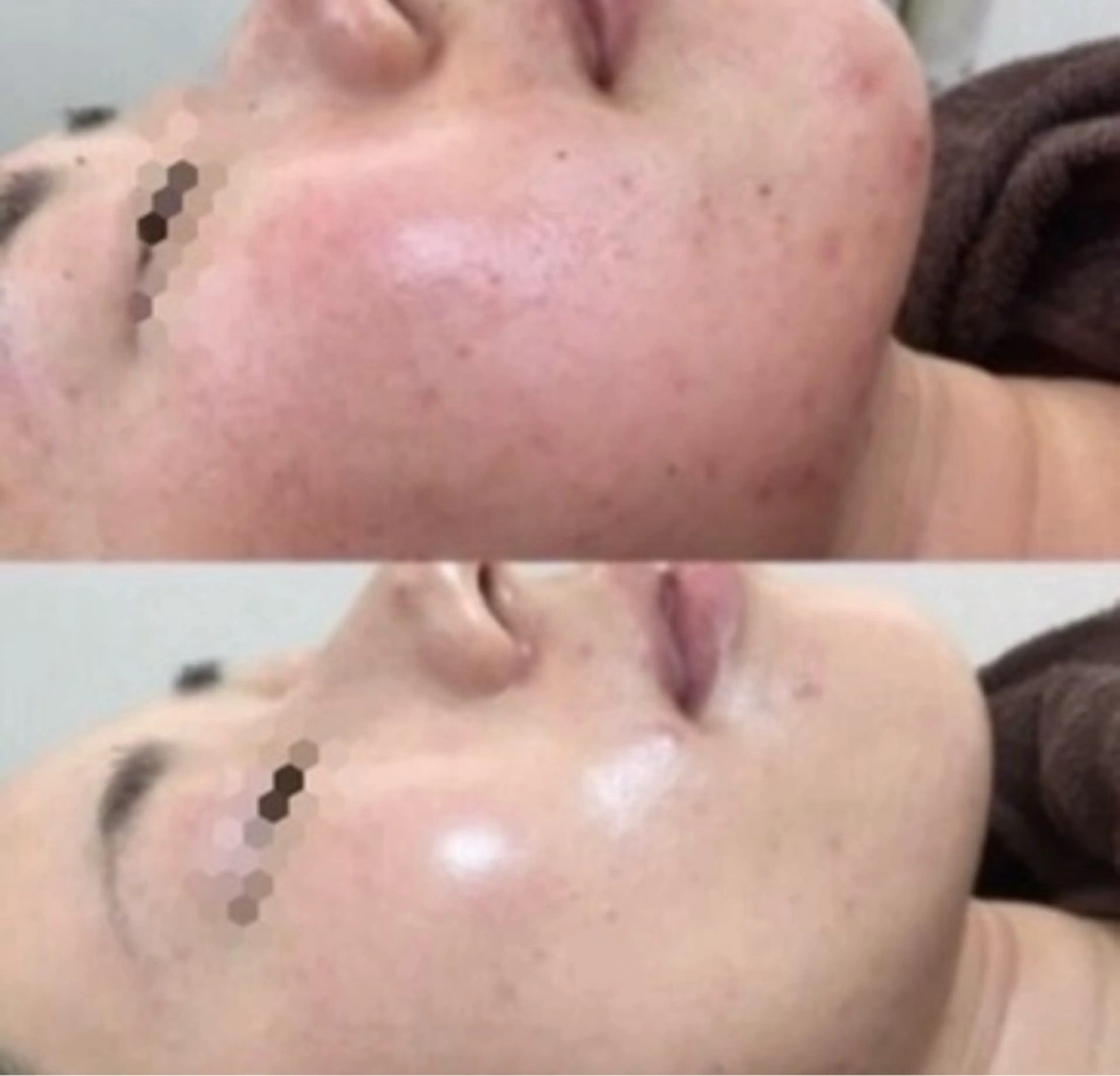 エステ 痩身専門サロン マハロミのエステ・リラクイメージ