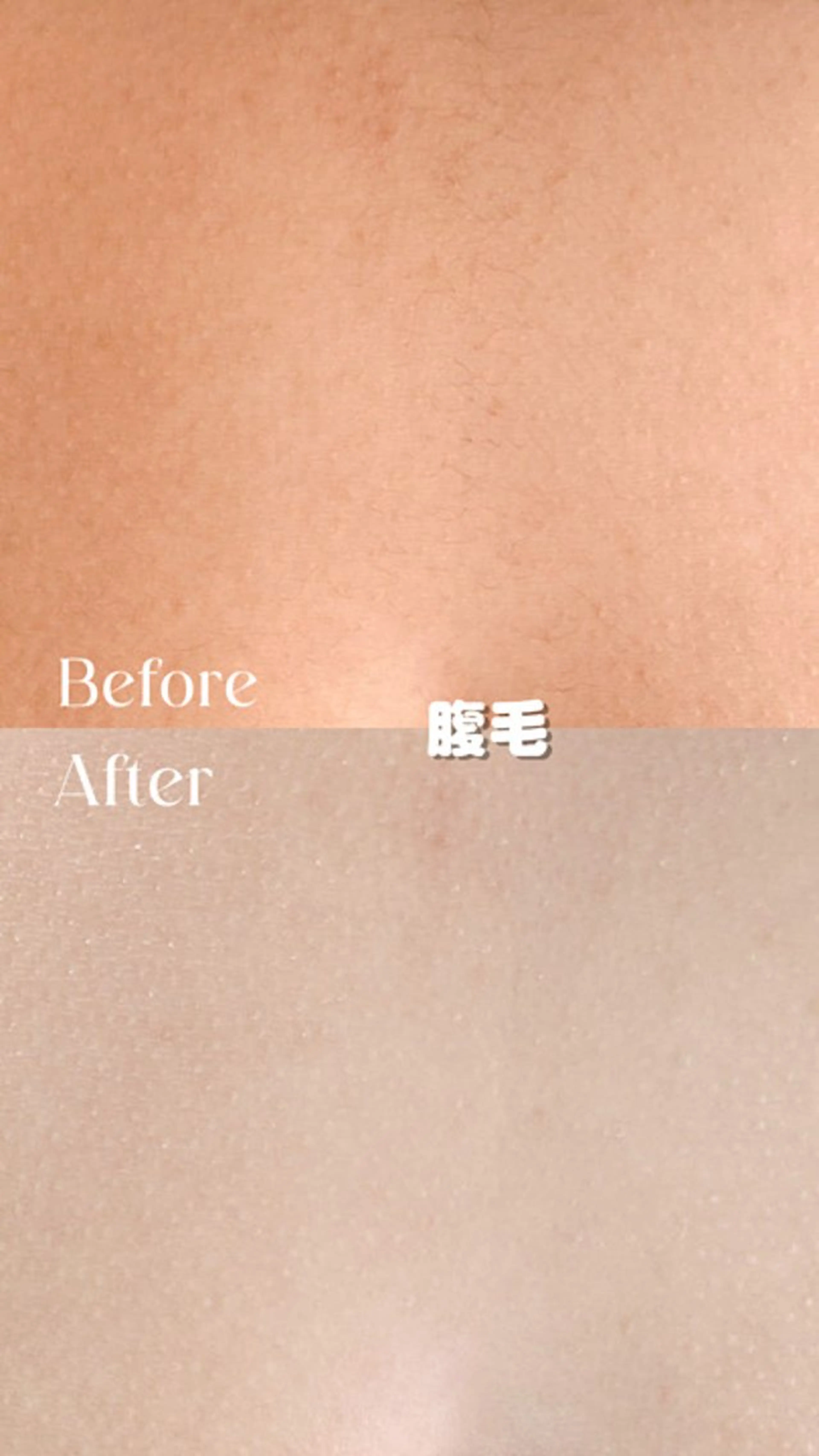 Hitomi シュガーリング豊橋のその他イメージ