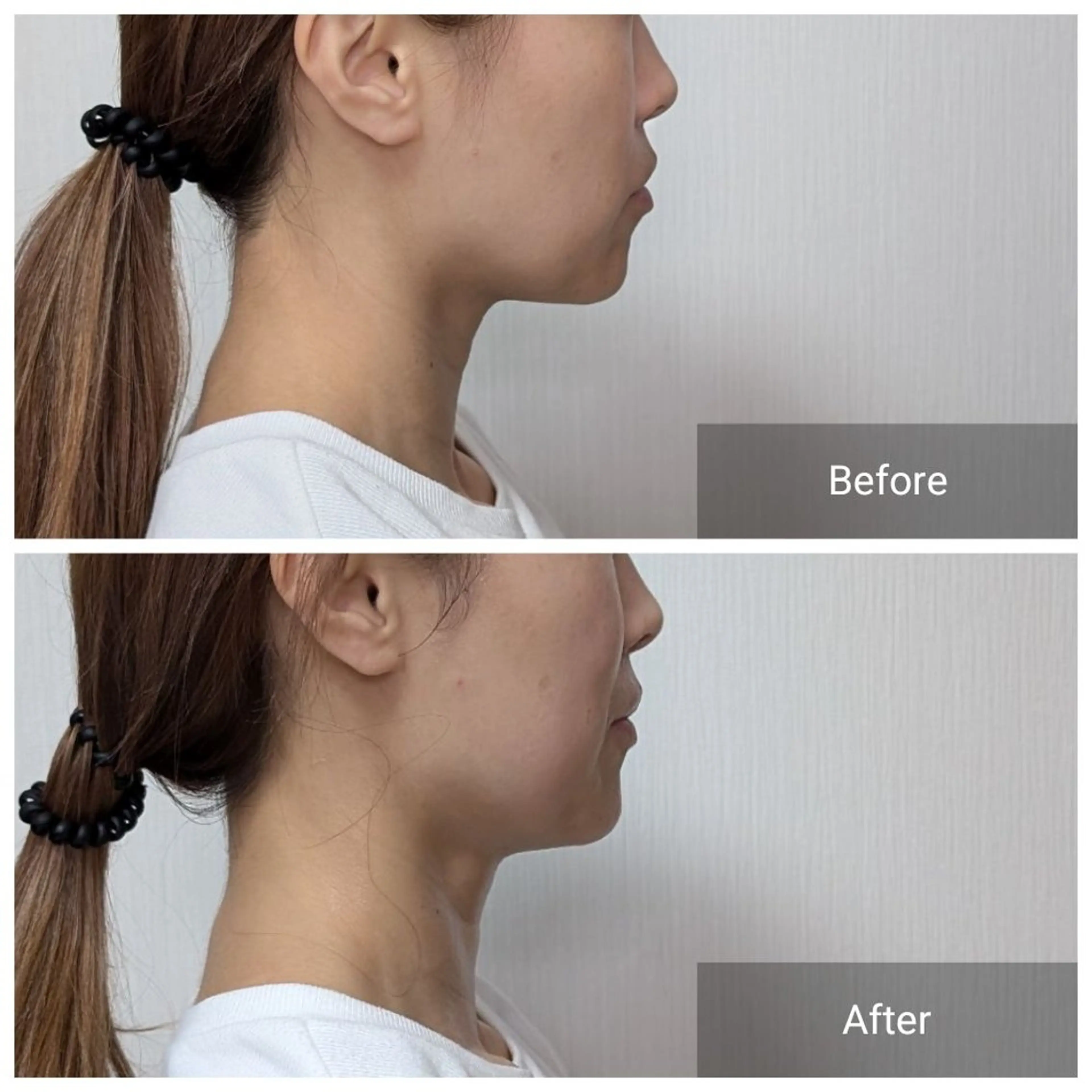 エステ nail RiRi アトレナチュラのエステ・リラクイメージ