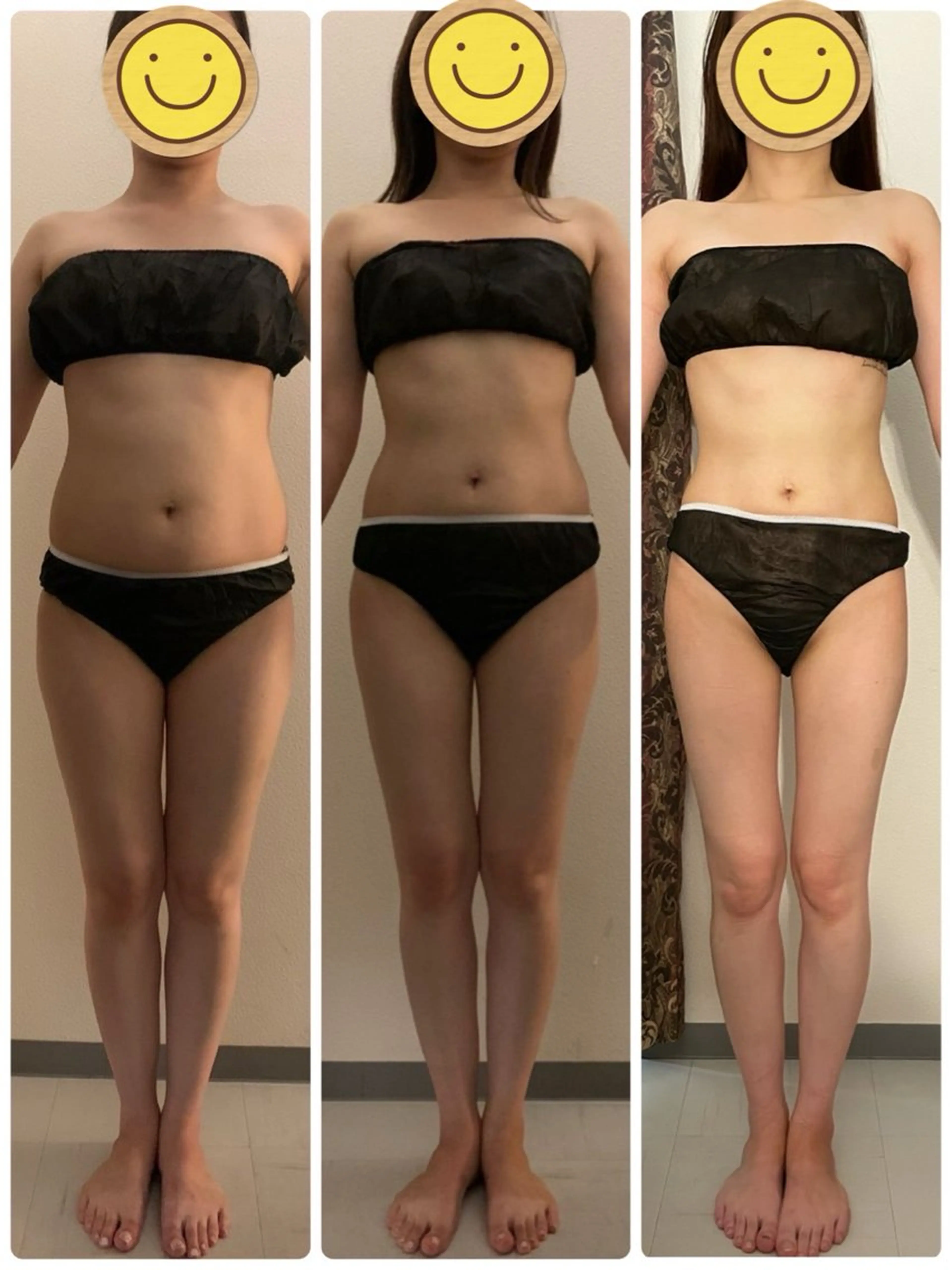 エステ 高速脱毛エステ リアンのエステ・リラクイメージ