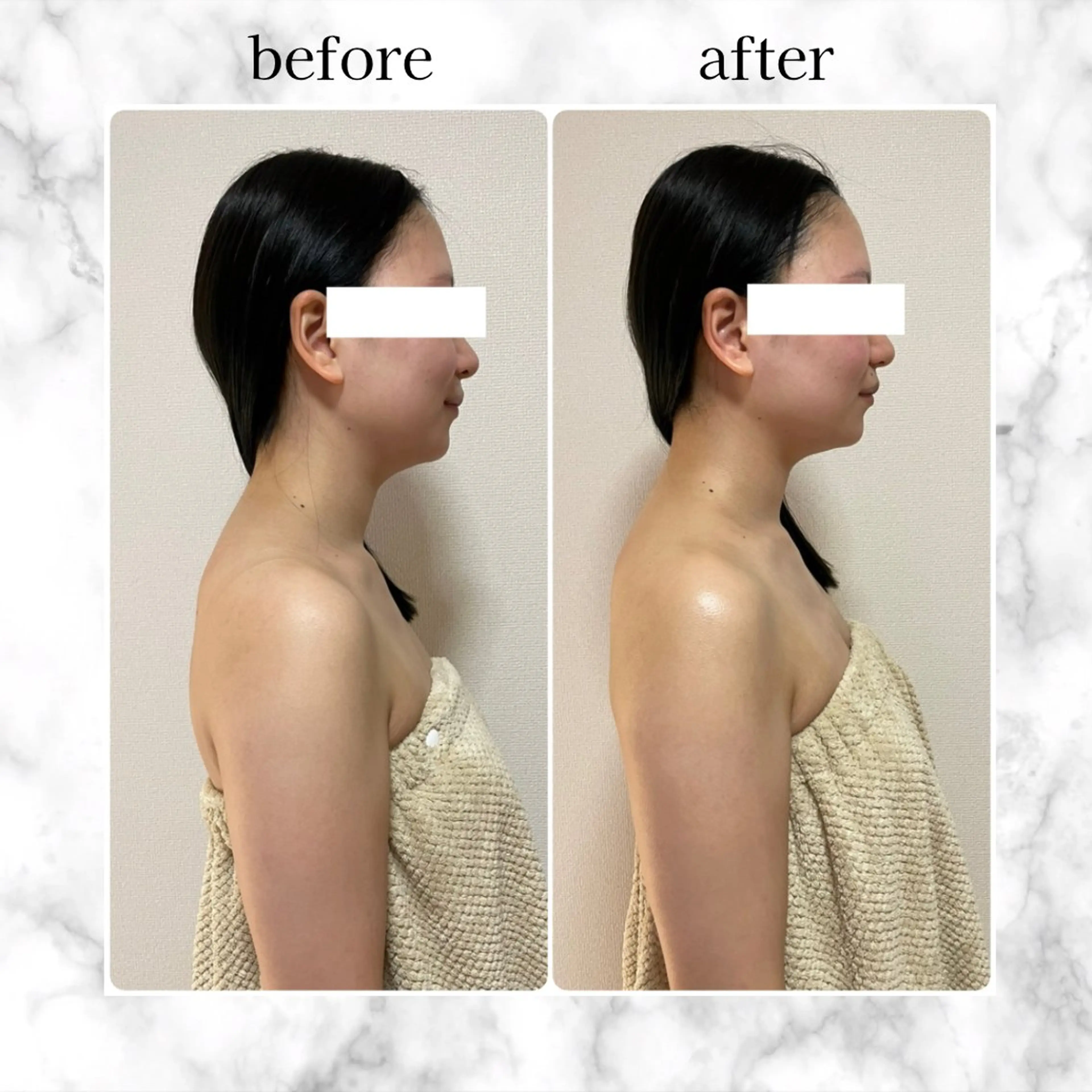 その他 イデアルMe♡ KIMISHIMAのその他イメージ