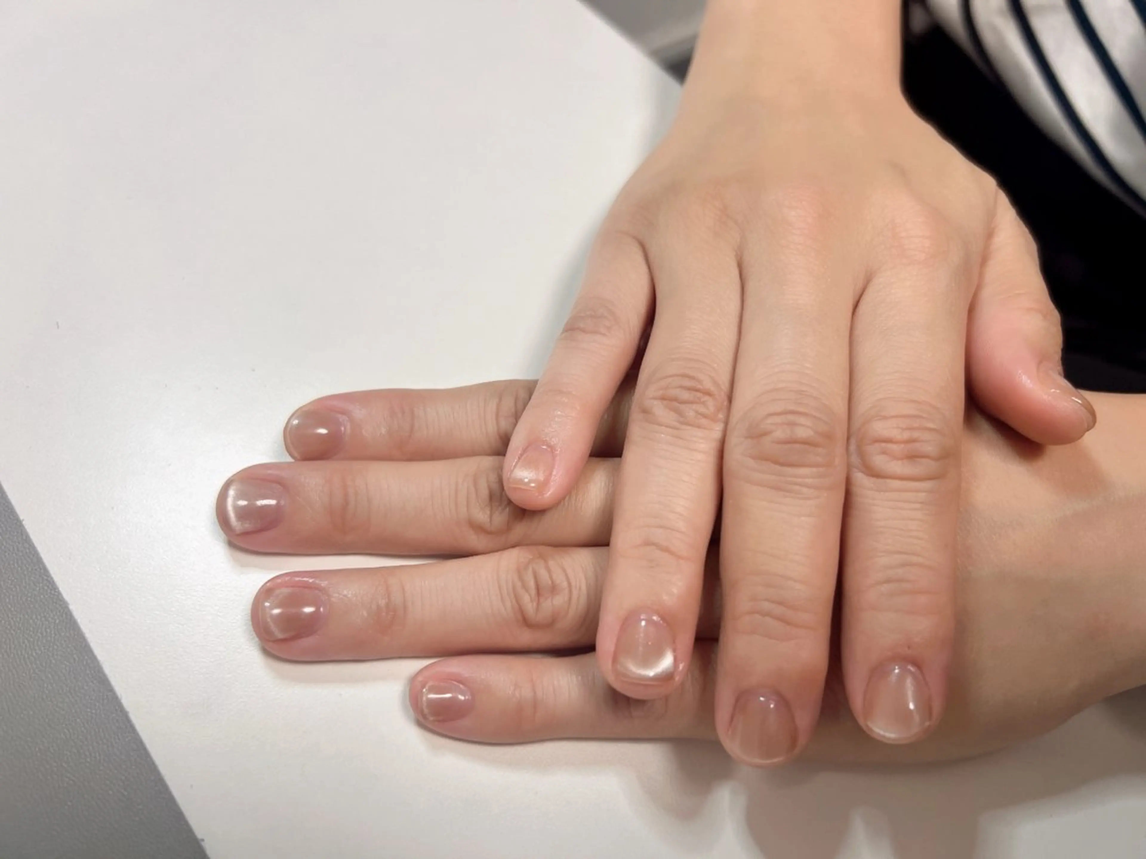 ハッドネイルの写真