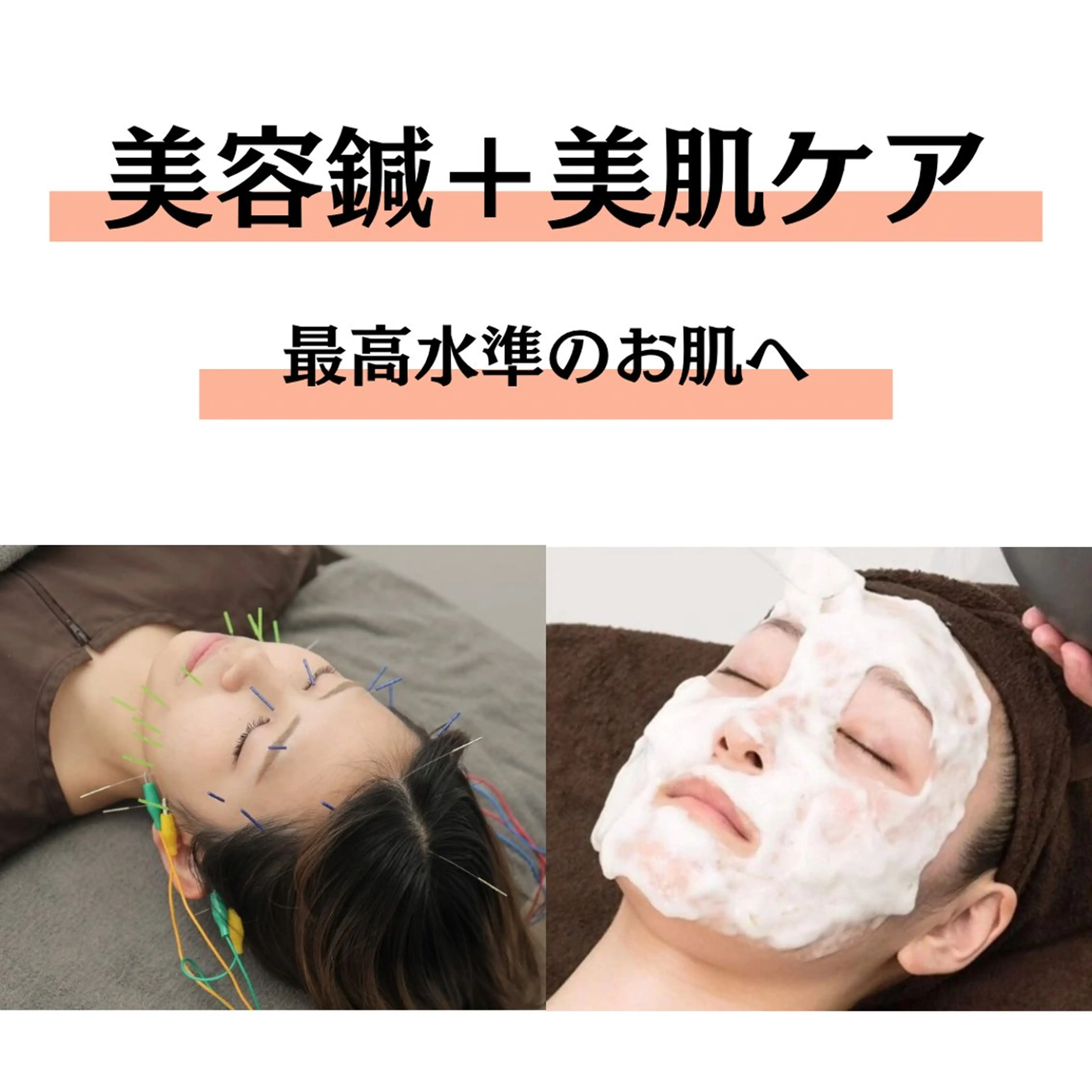 【🪡初回限定🪡】美容鍼+美肌クレンジング+炭酸パック(90分)の写真