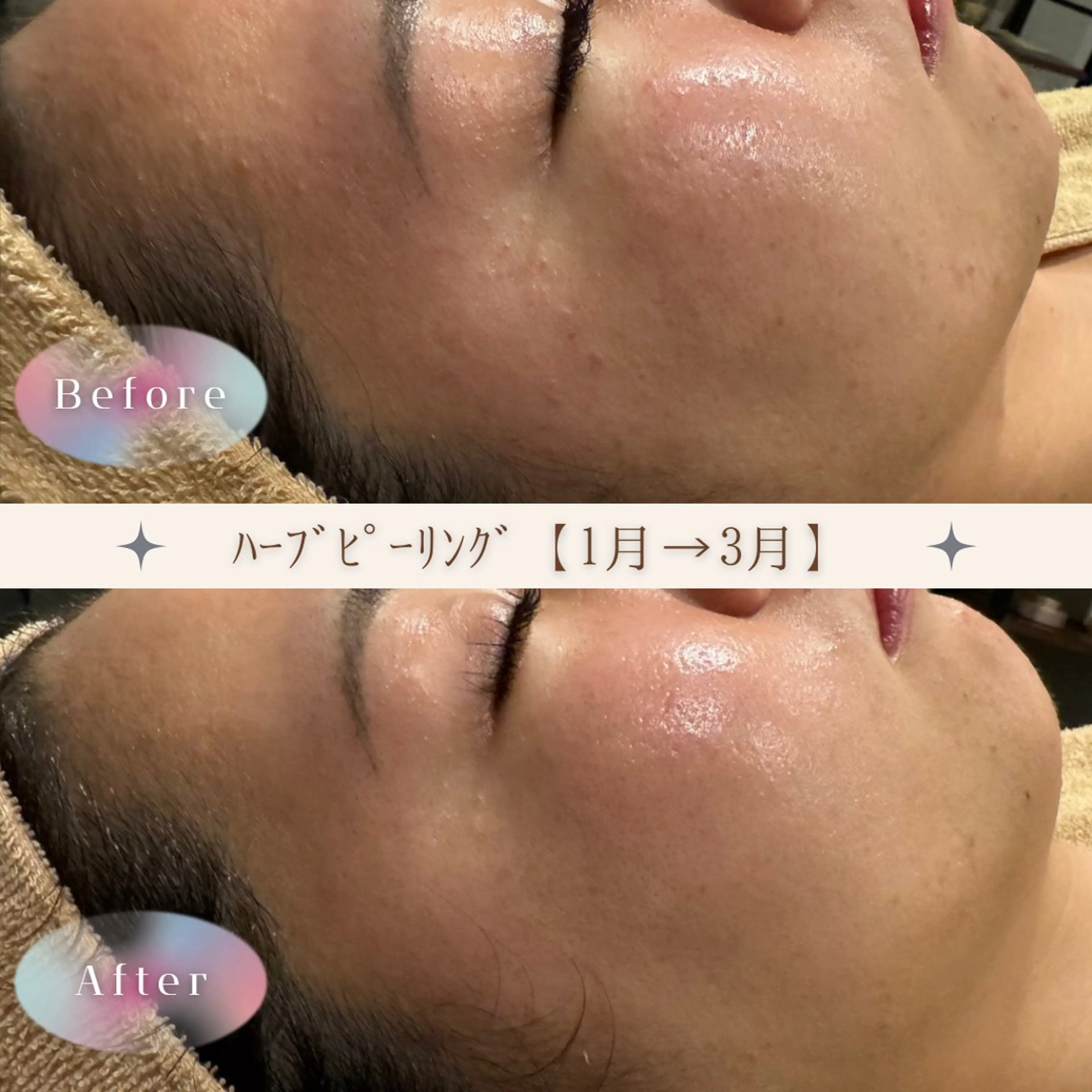 エステ ゆか/エステサロン Lilasmileのエステ・リラクイメージ