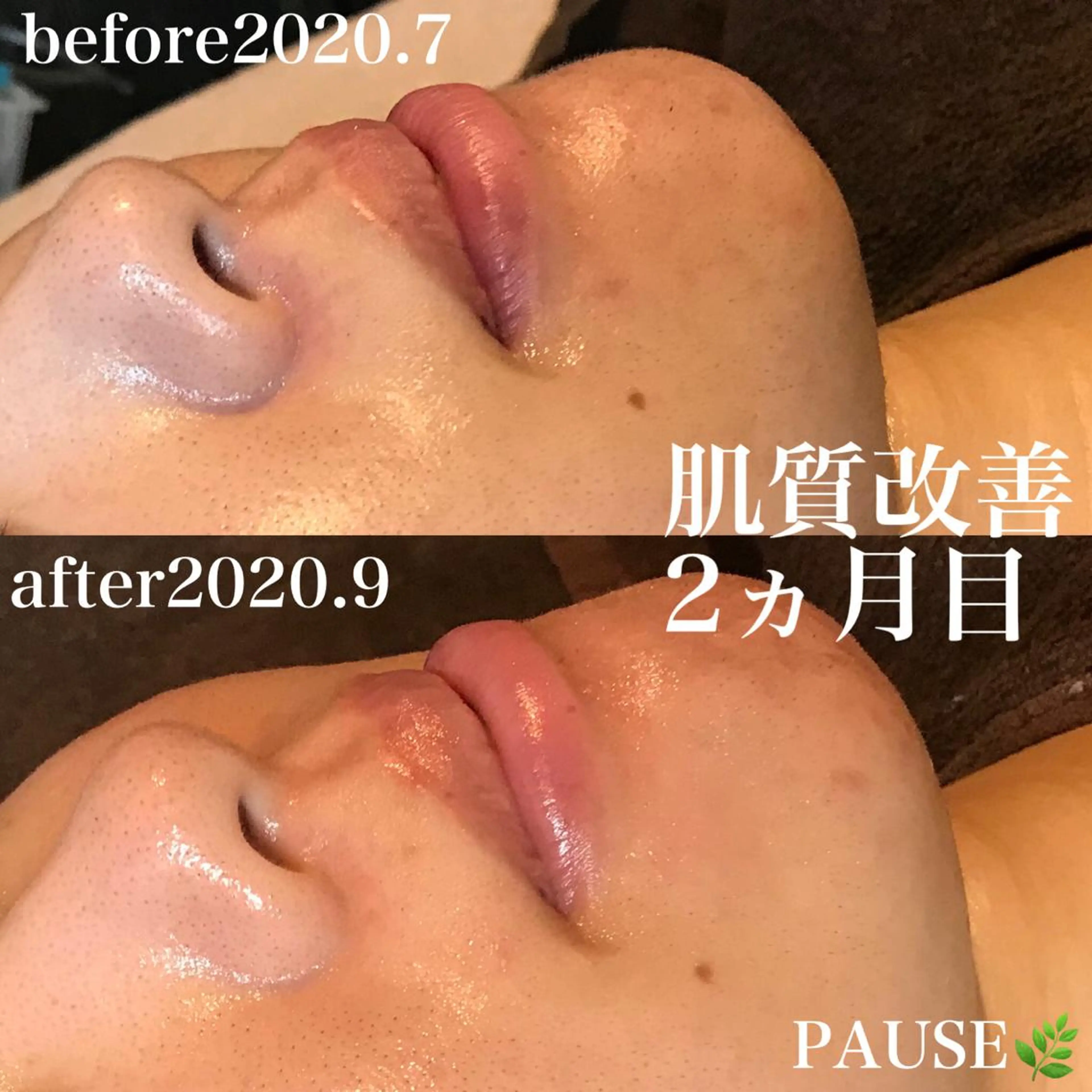 エステ 浜野 恵美のエステ・リラクイメージ