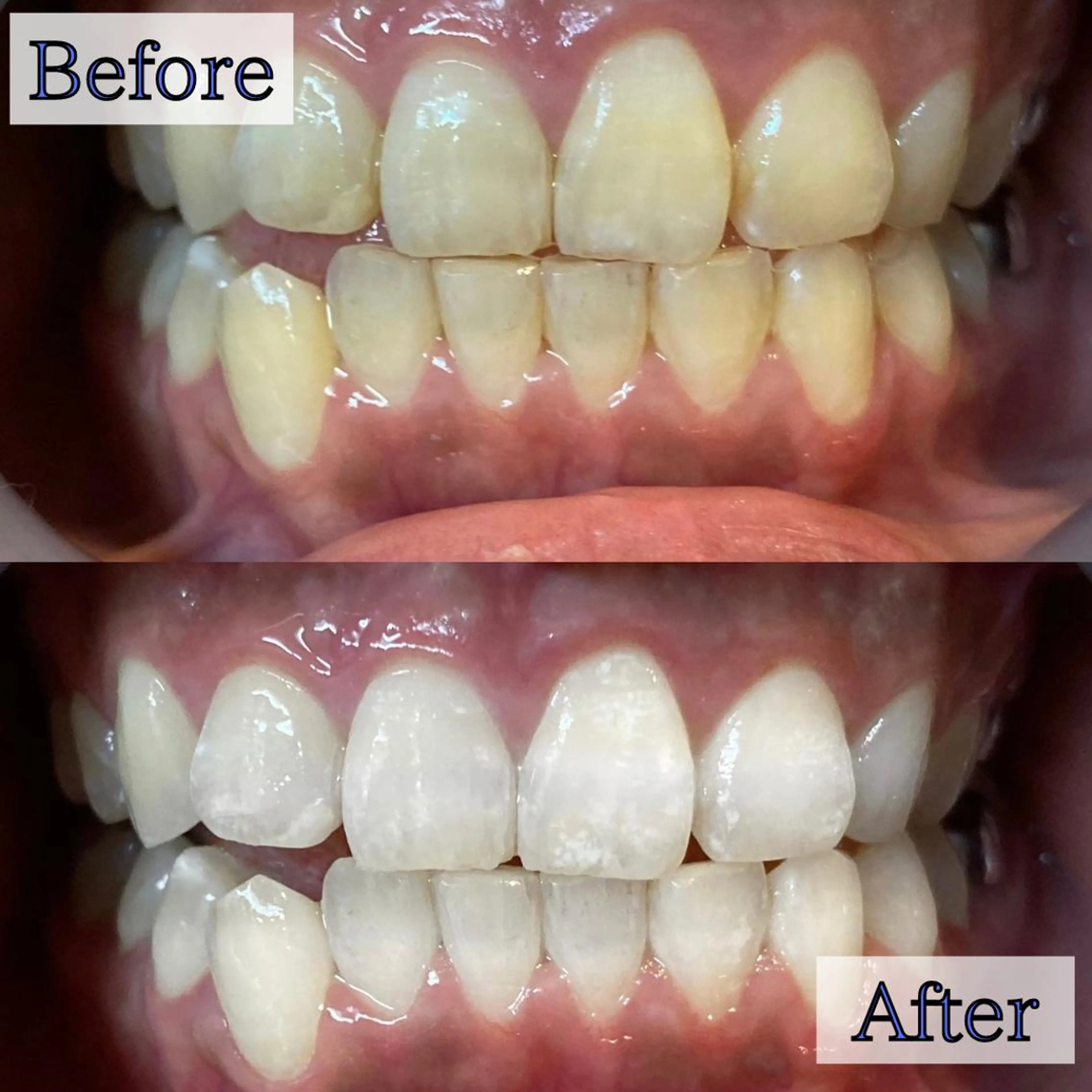 その他 LBSホワイトニング 新宿店💎店長のエステ・リラクイメージ