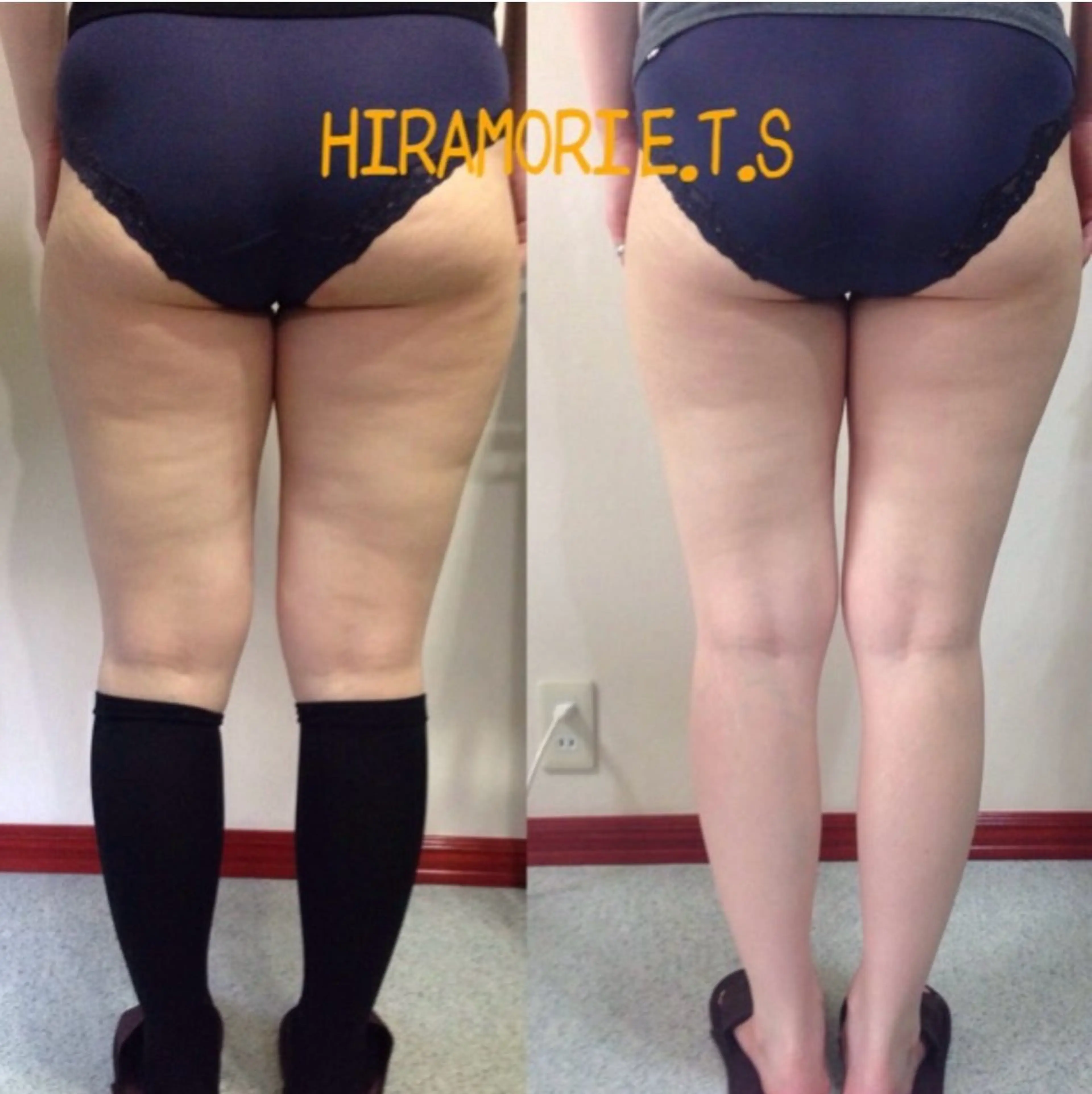 ボディーケアの写真