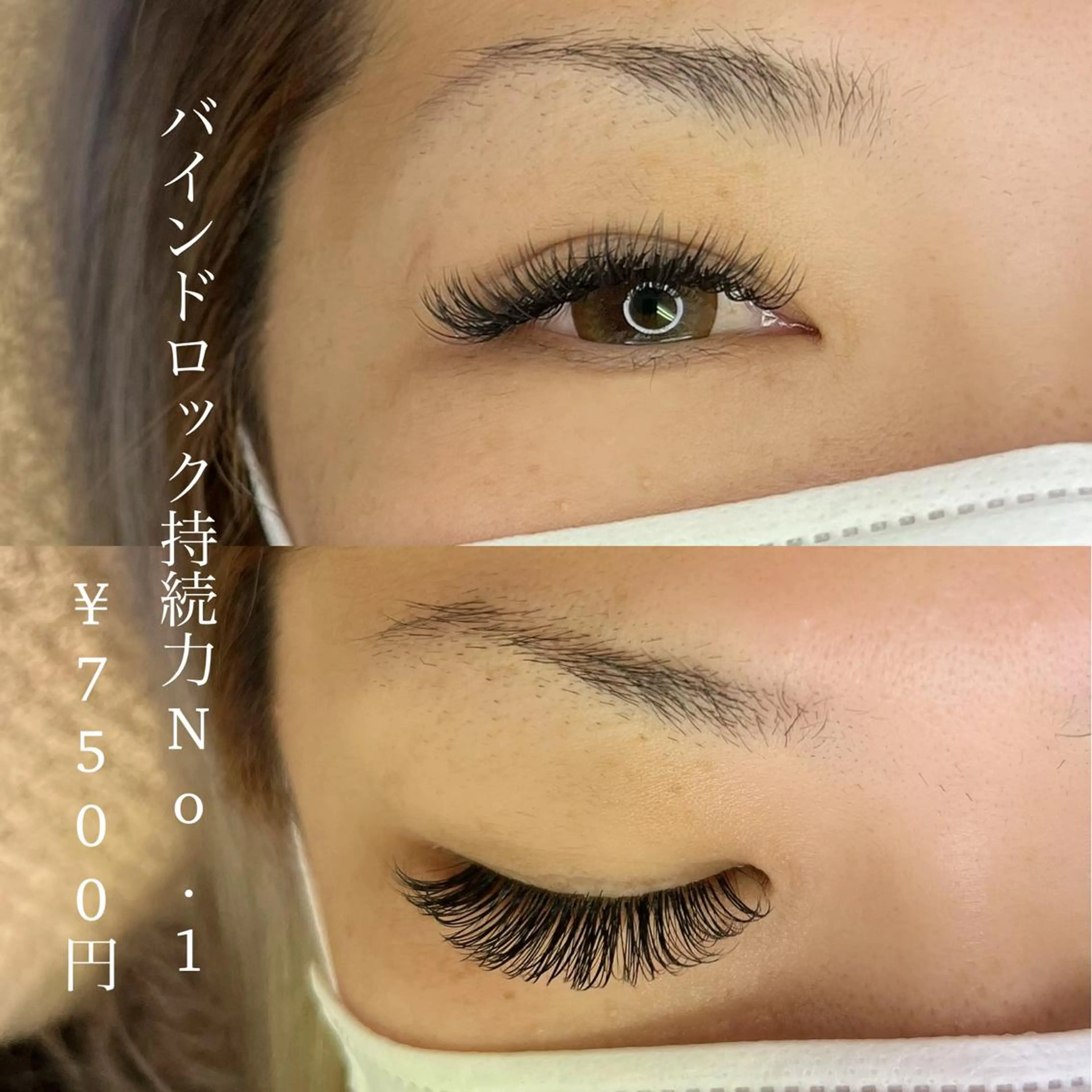 バインドロック付け放題の写真