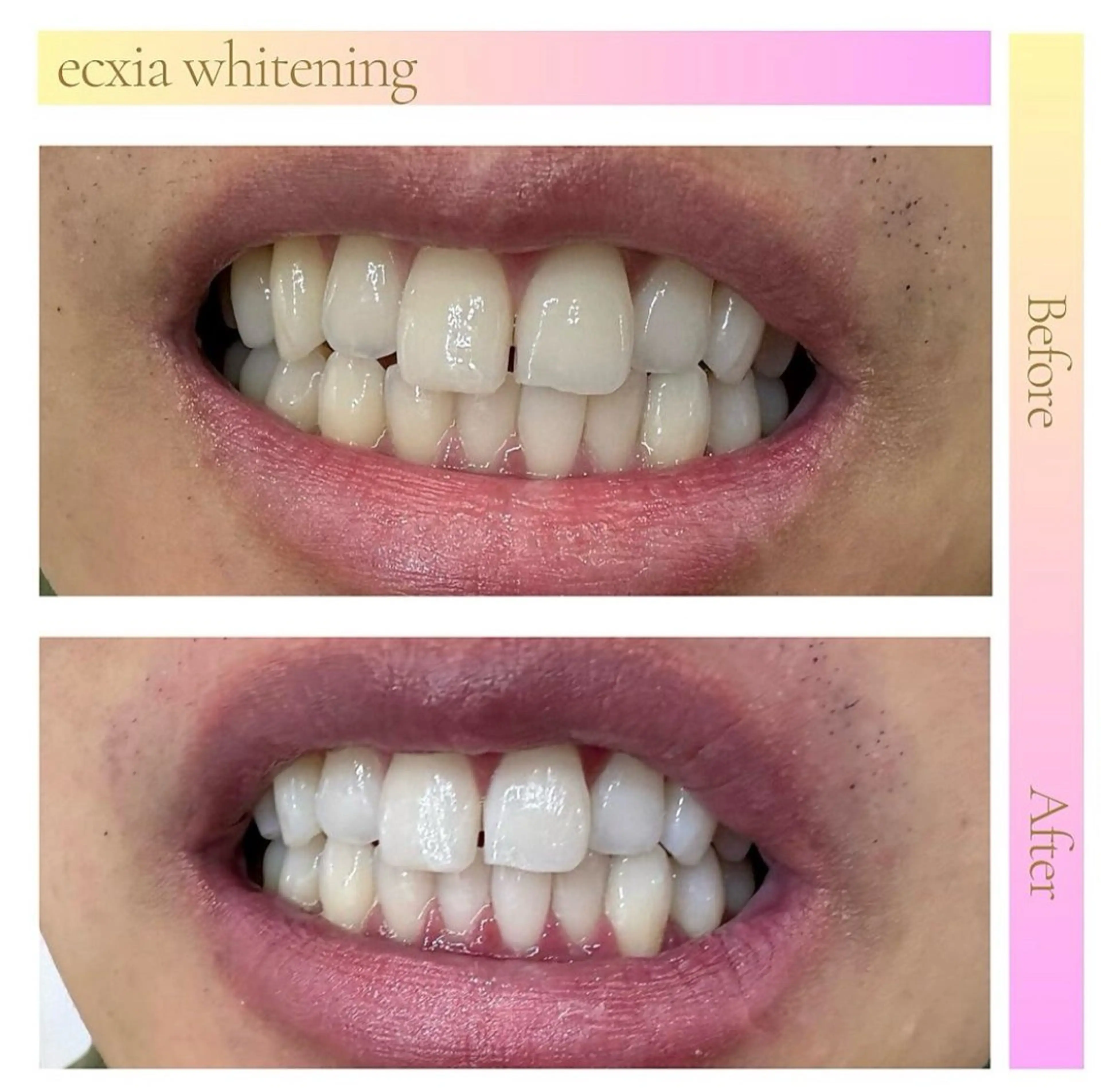 セルフホワイトニング エクシア武蔵小杉店のその他イメージ