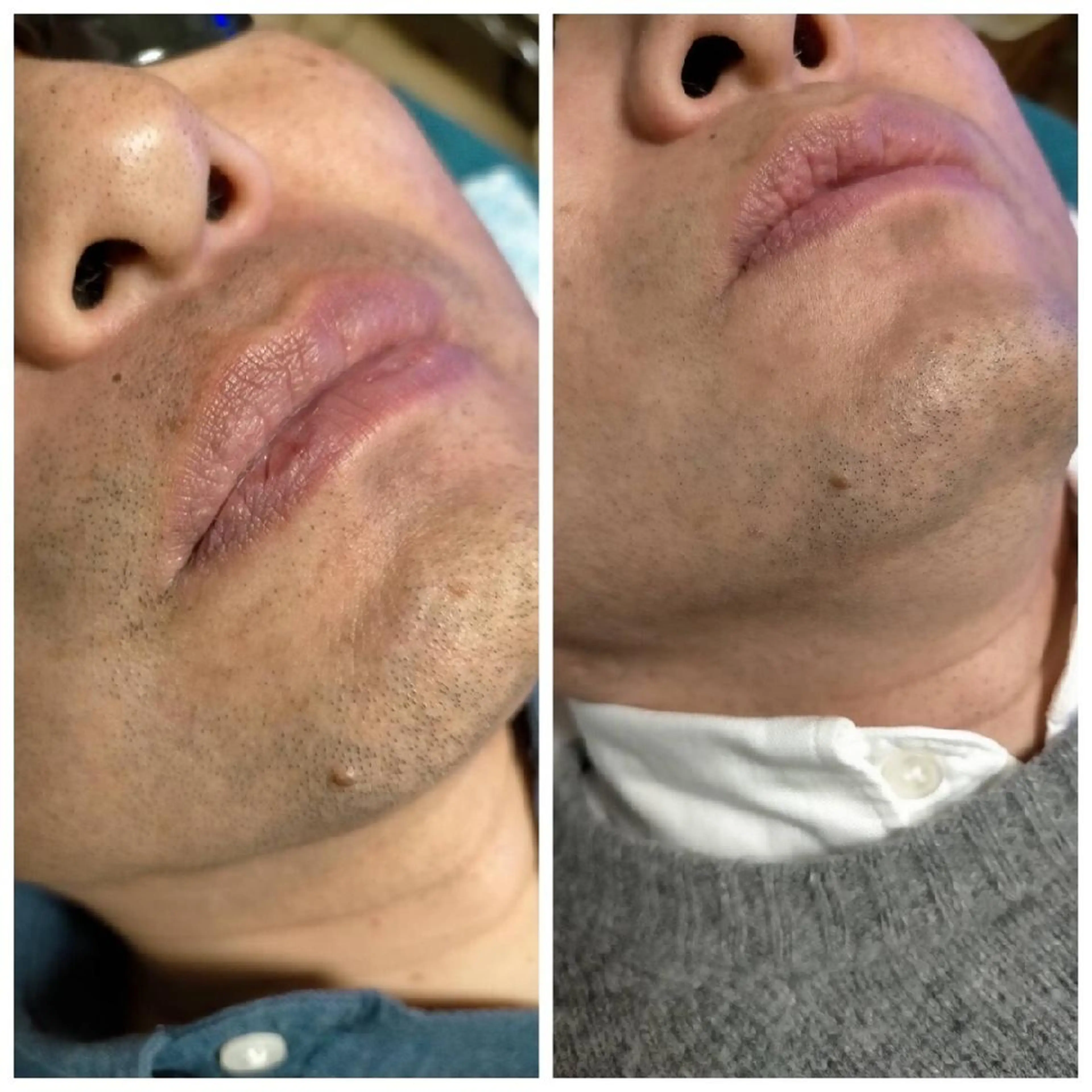 メンズ jonny's beautyのエステ・リラクイメージ