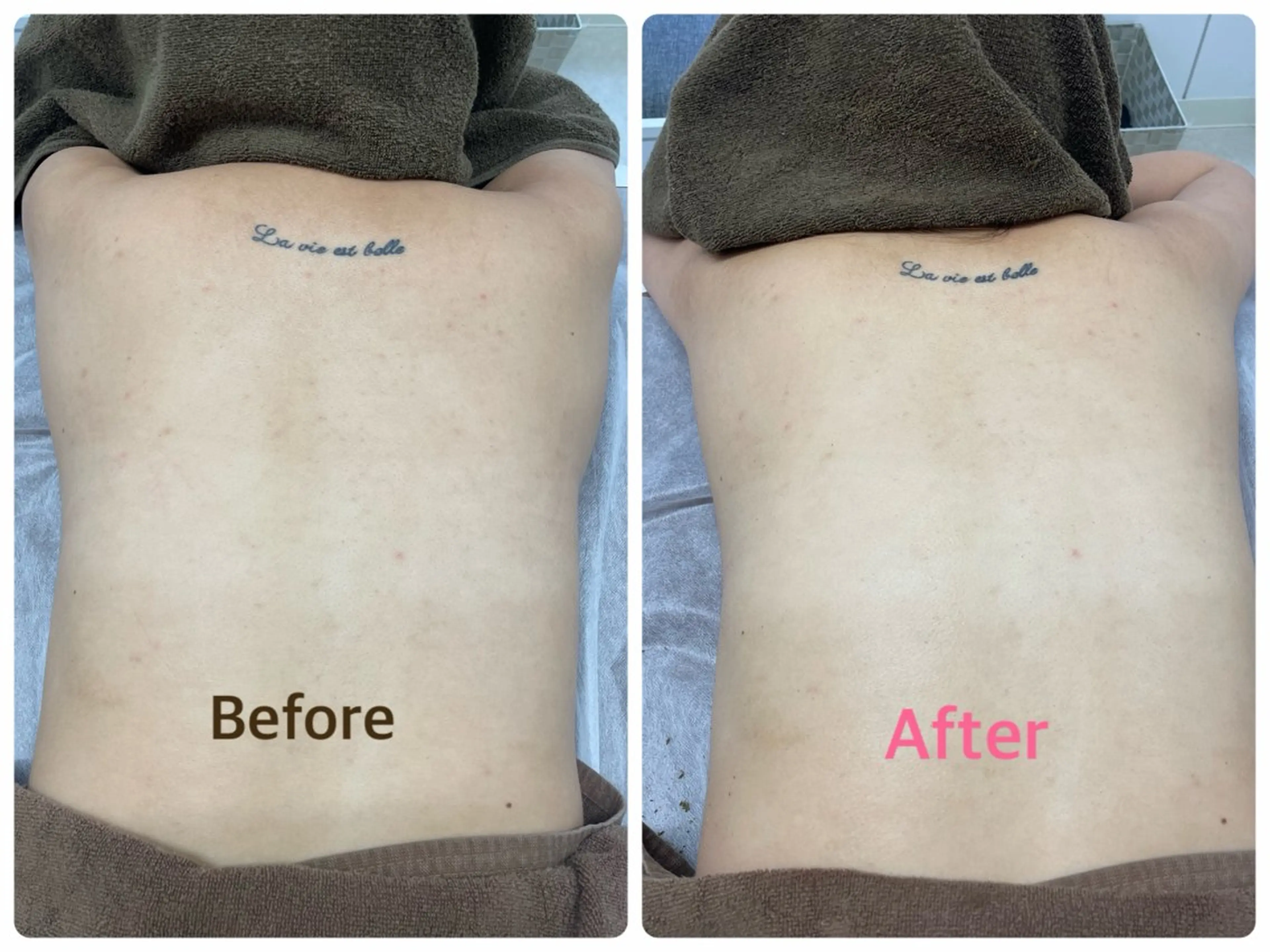 エステ 脱毛サロンMIRUS Yuukaのエステ・リラクイメージ