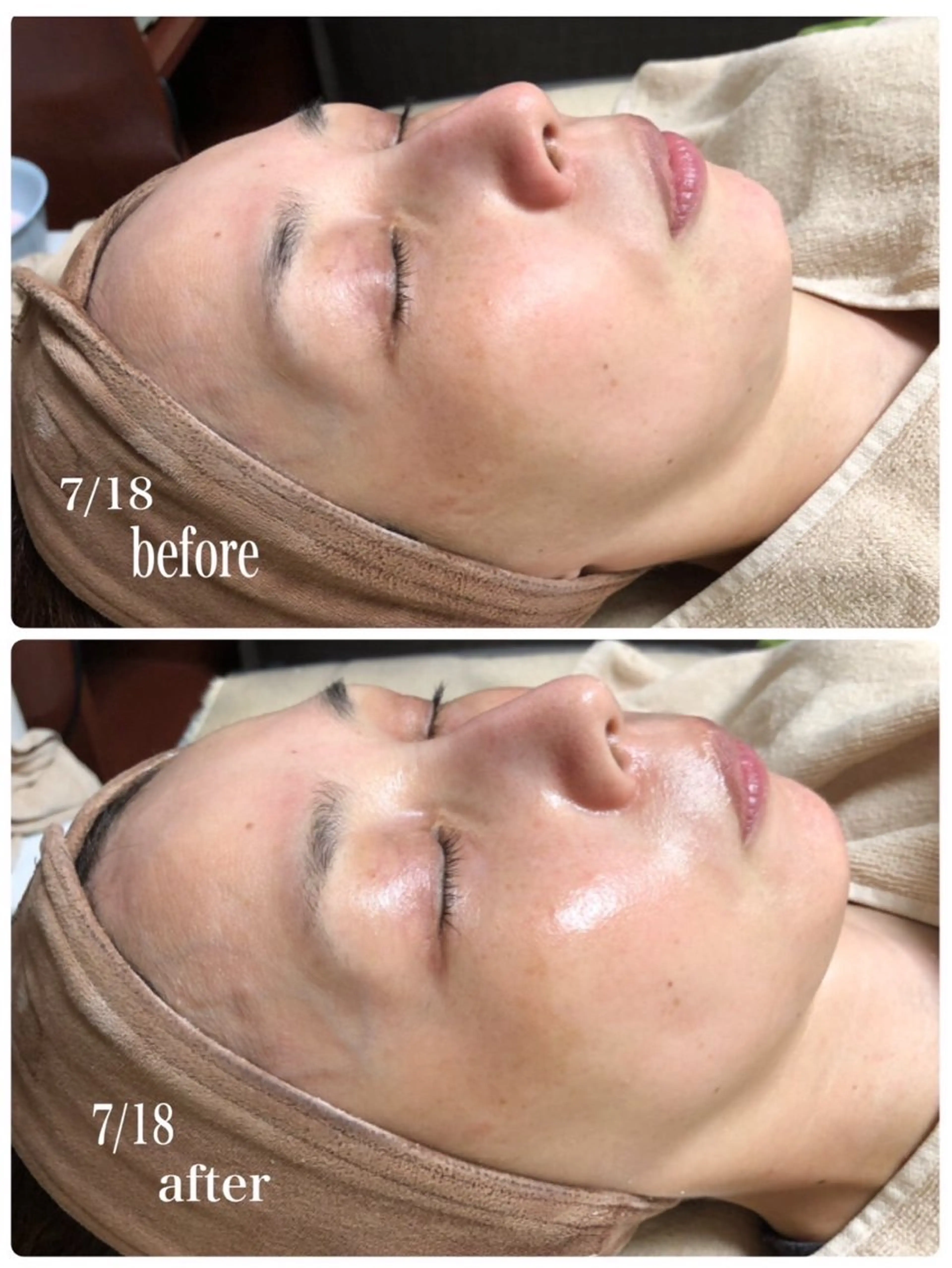 エステ サロンド ポラリスのエステ・リラクイメージ