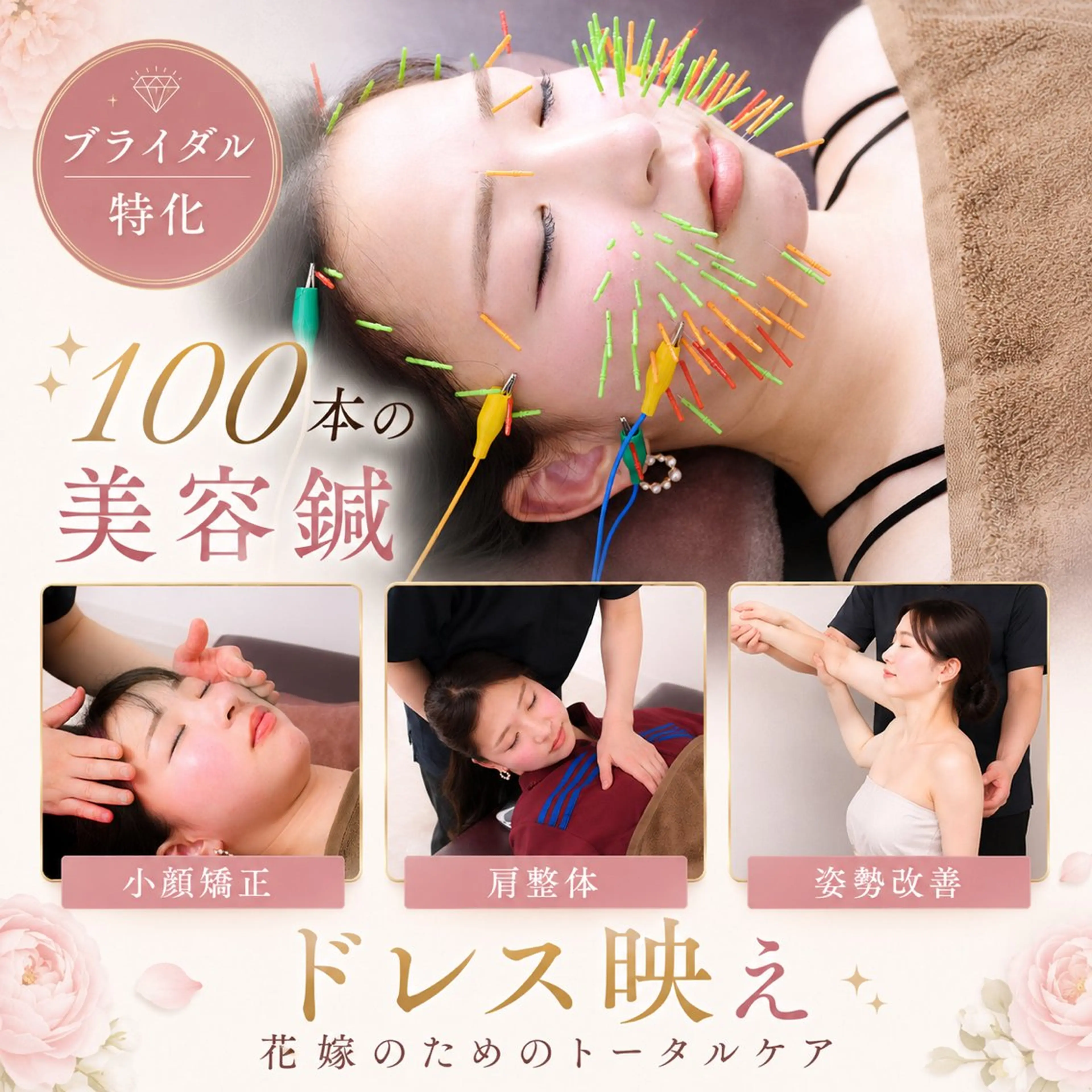 【ブライダル特化】花嫁美容鍼×小顔矯正×肩整体でドレス映え♪の写真