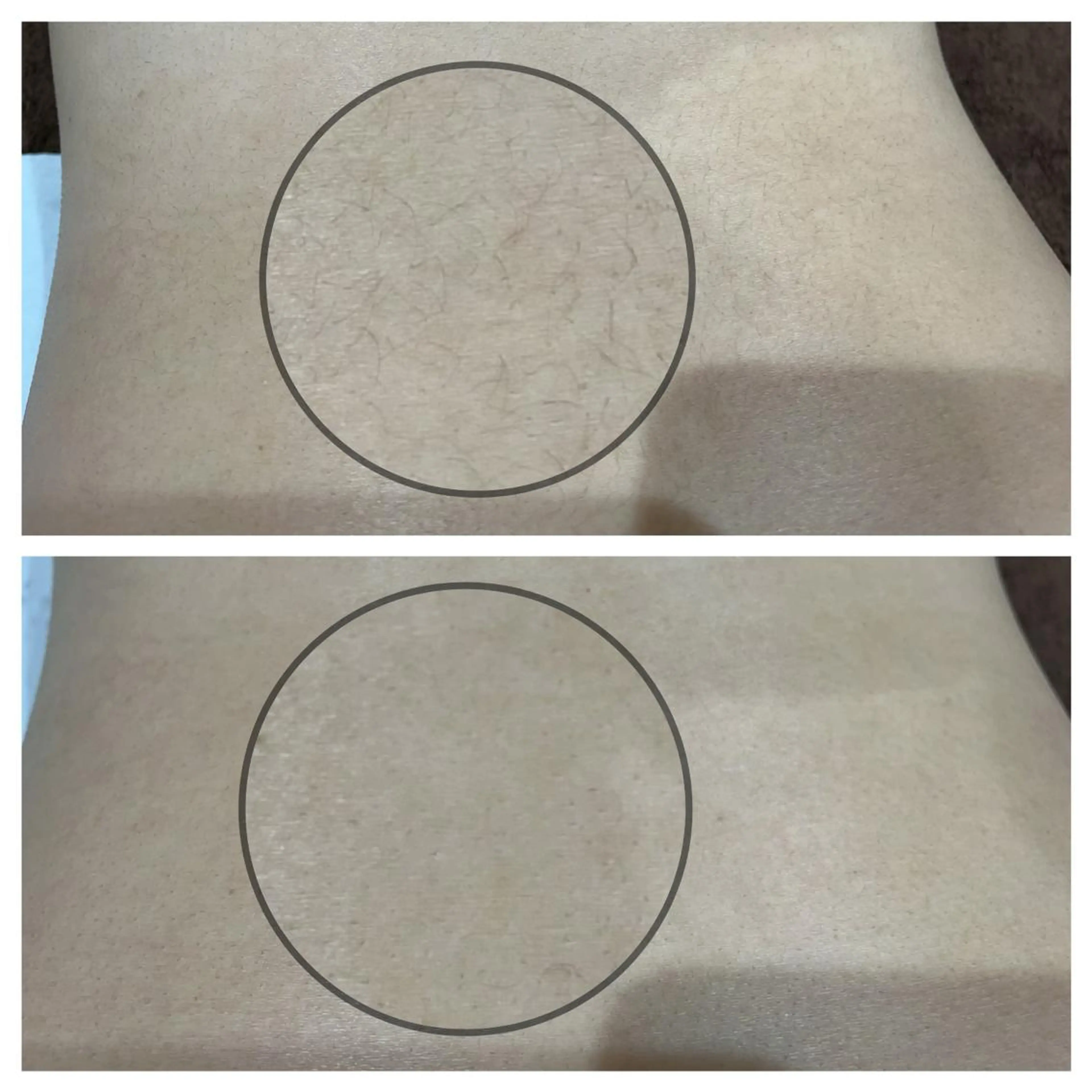 脱毛 tejina suuのエステ・リラクイメージ