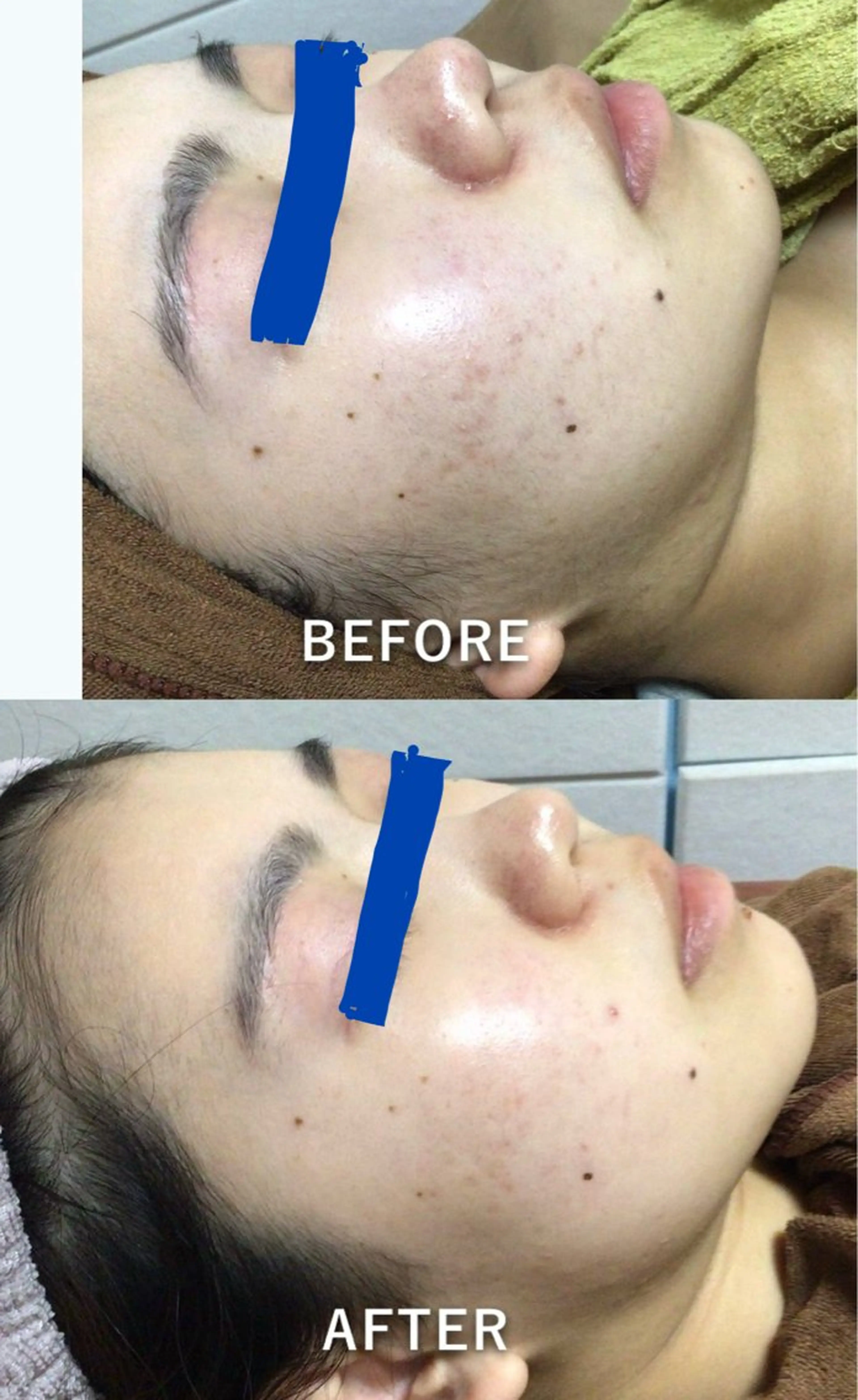 エステ 仲澤 千春のその他イメージ