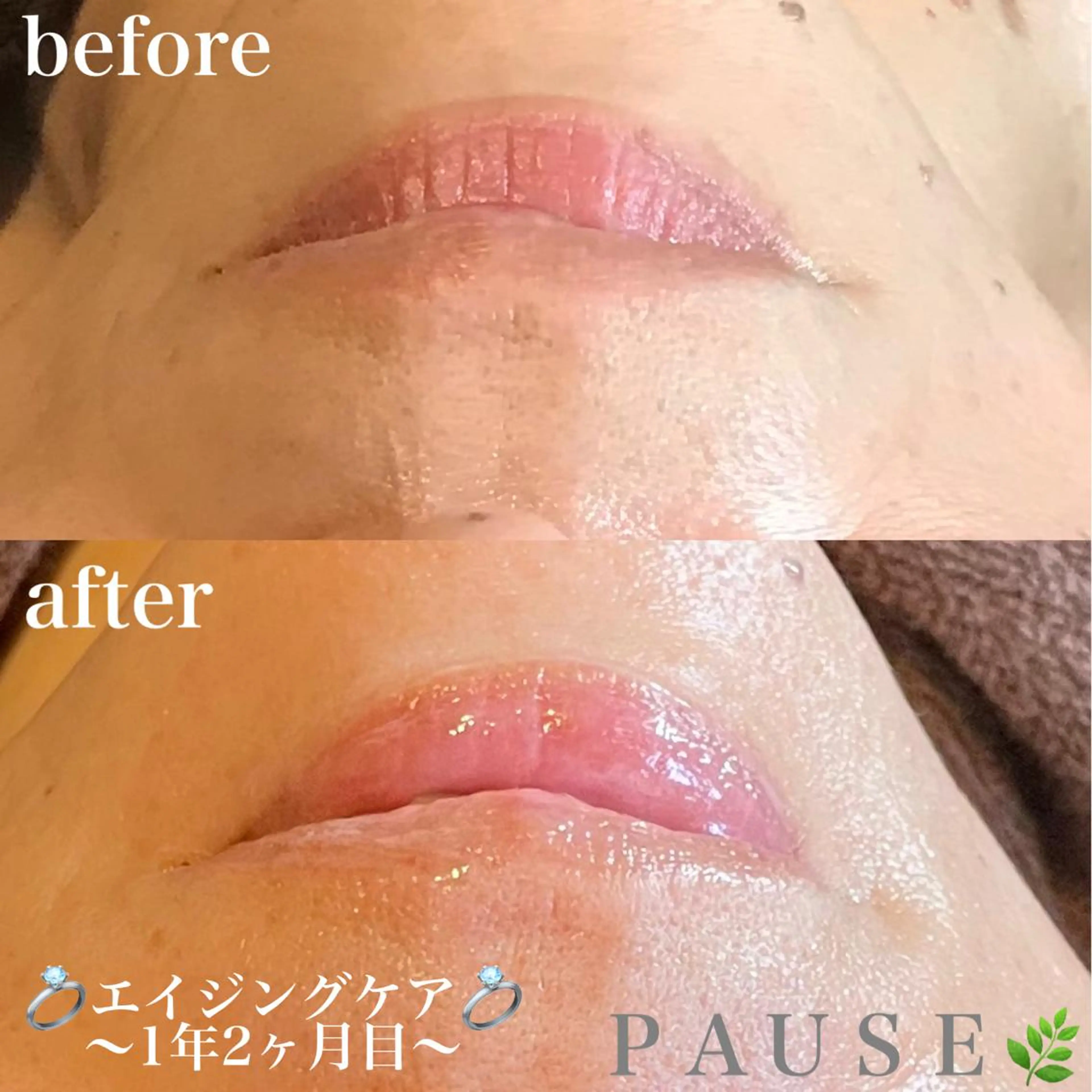 エステ 浜野 恵美のエステ・リラクイメージ