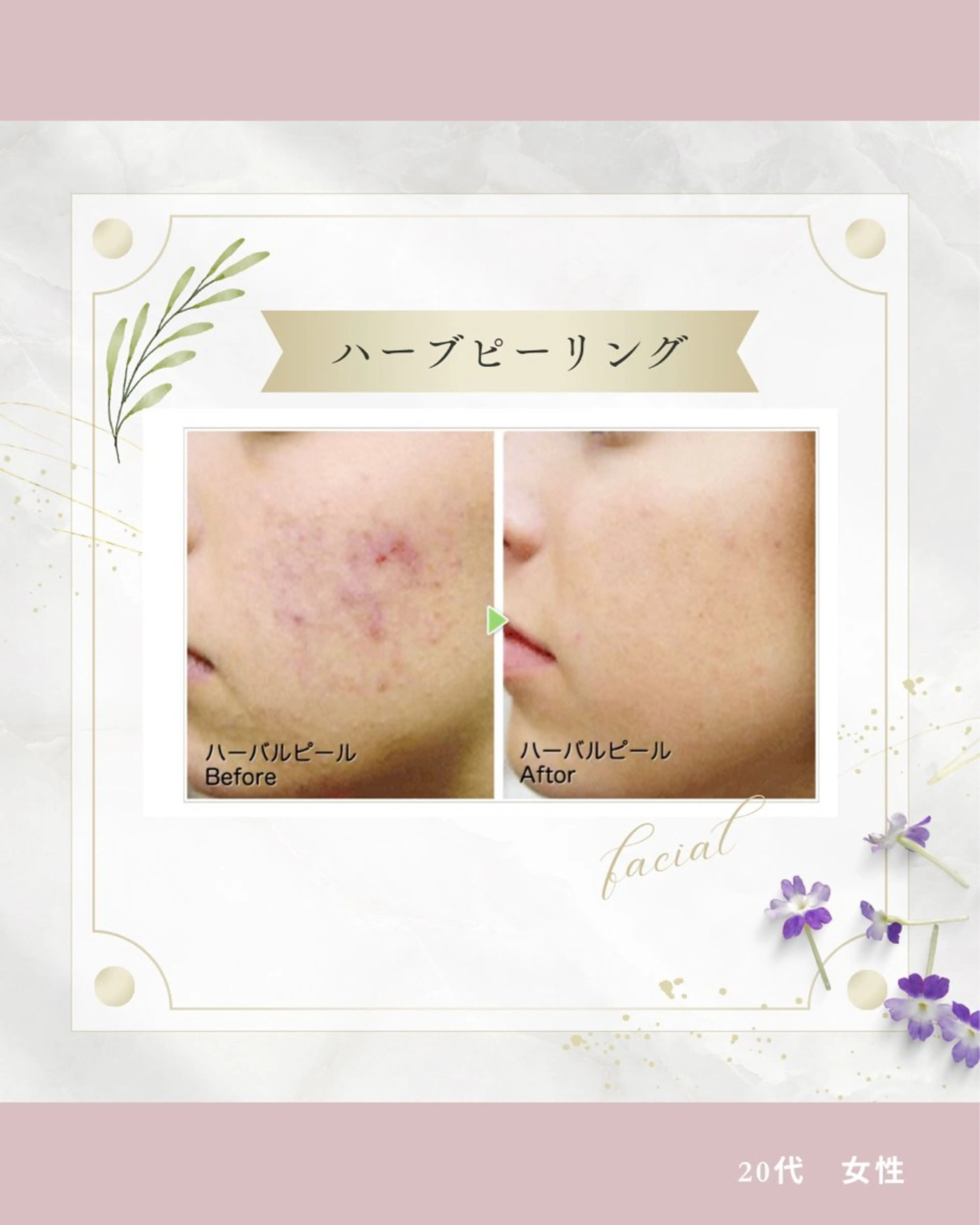 《 肌質×美肌 》 addissimoのエステ・リラクイメージ