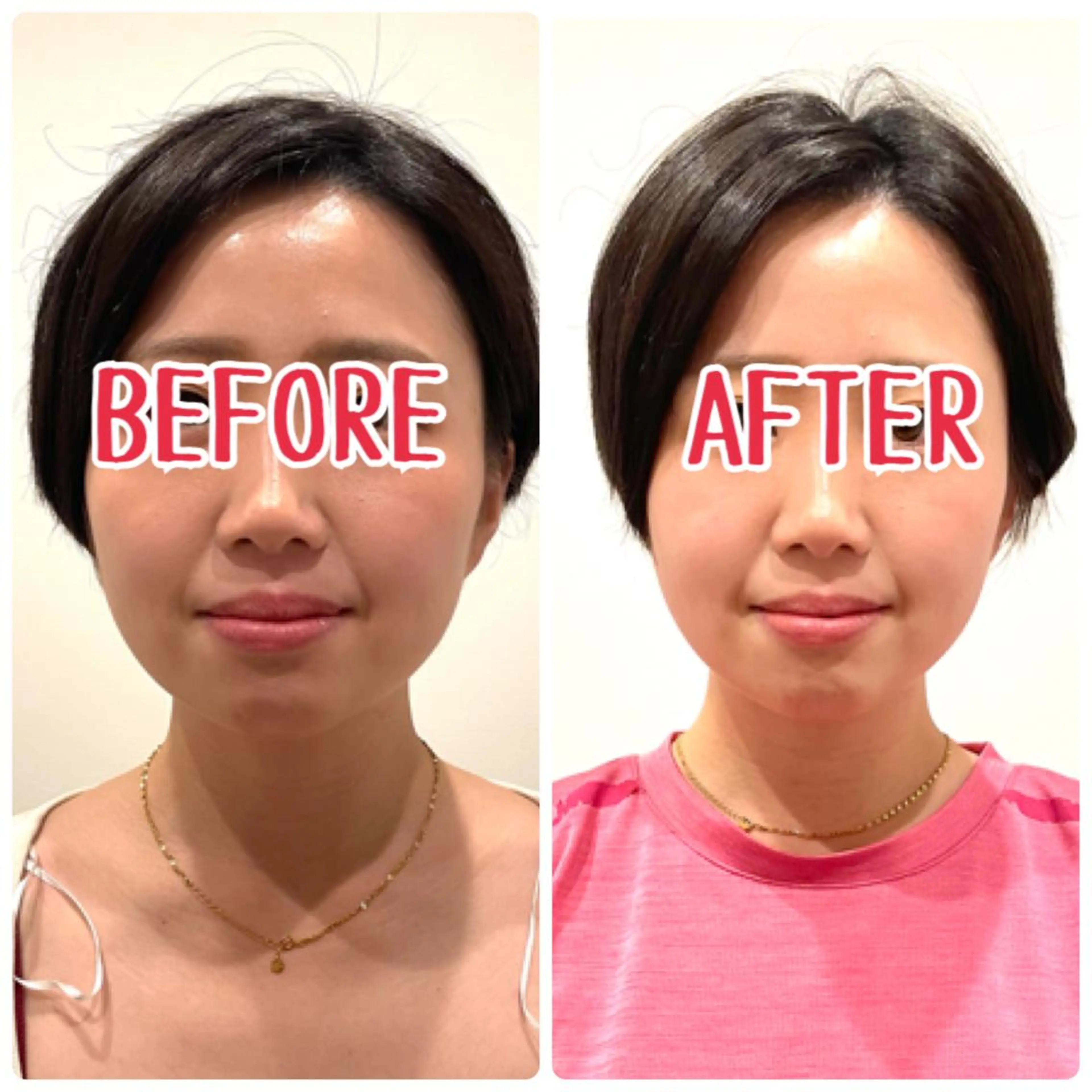 整体×美容鍼 ジェイペックのエステ・リラクイメージ