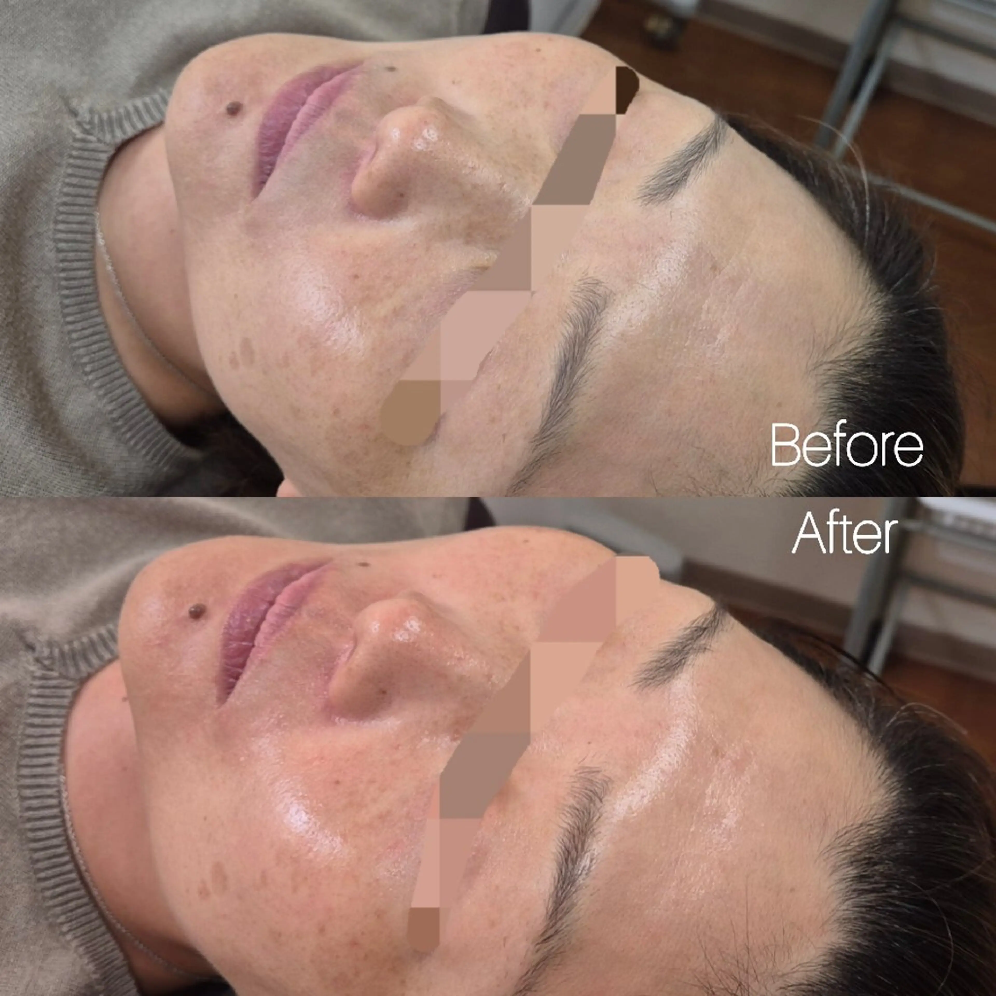 エステ 岩本 ひなののエステ・リラクイメージ