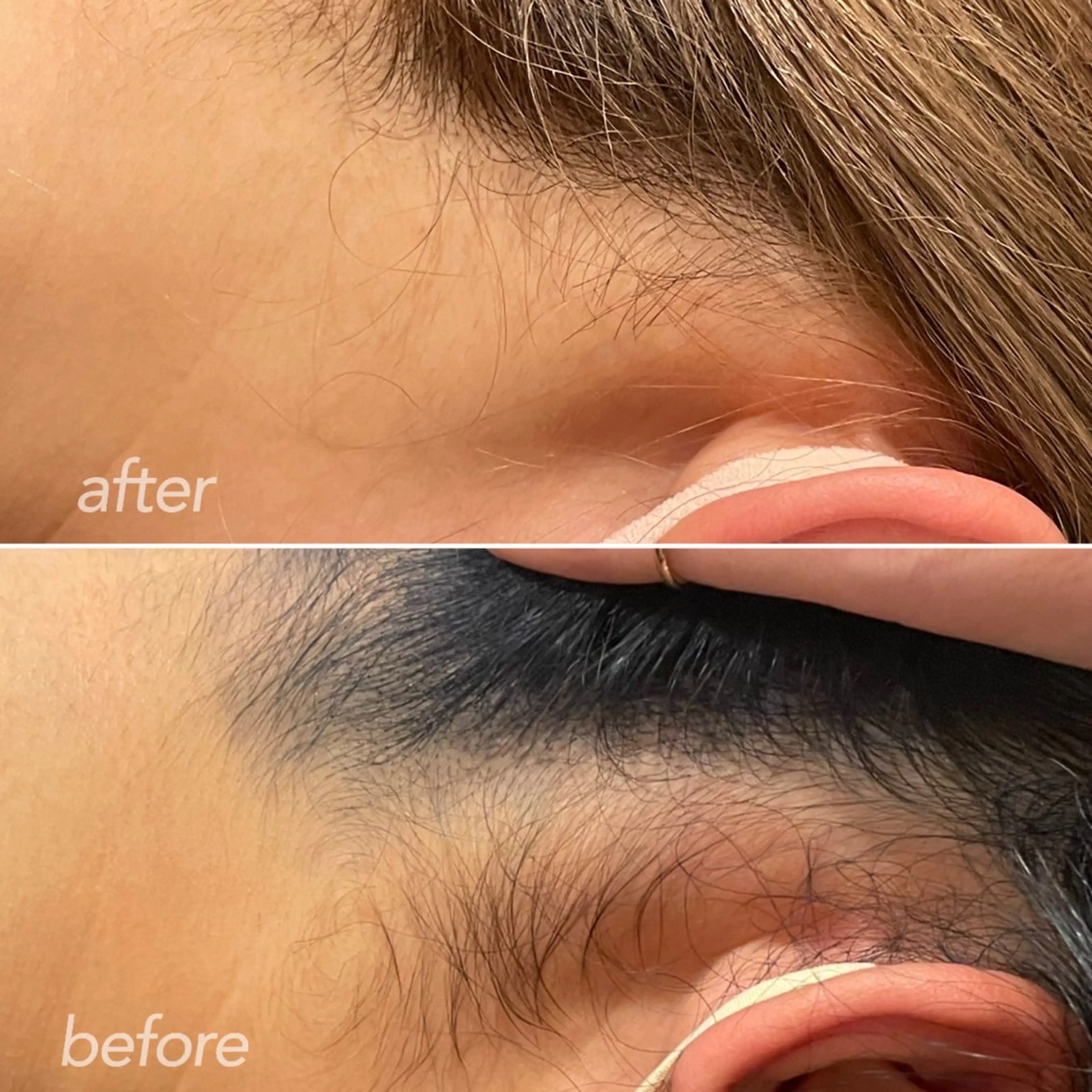 脱毛 越野 Tulipe栄店のエステ・リラクイメージ