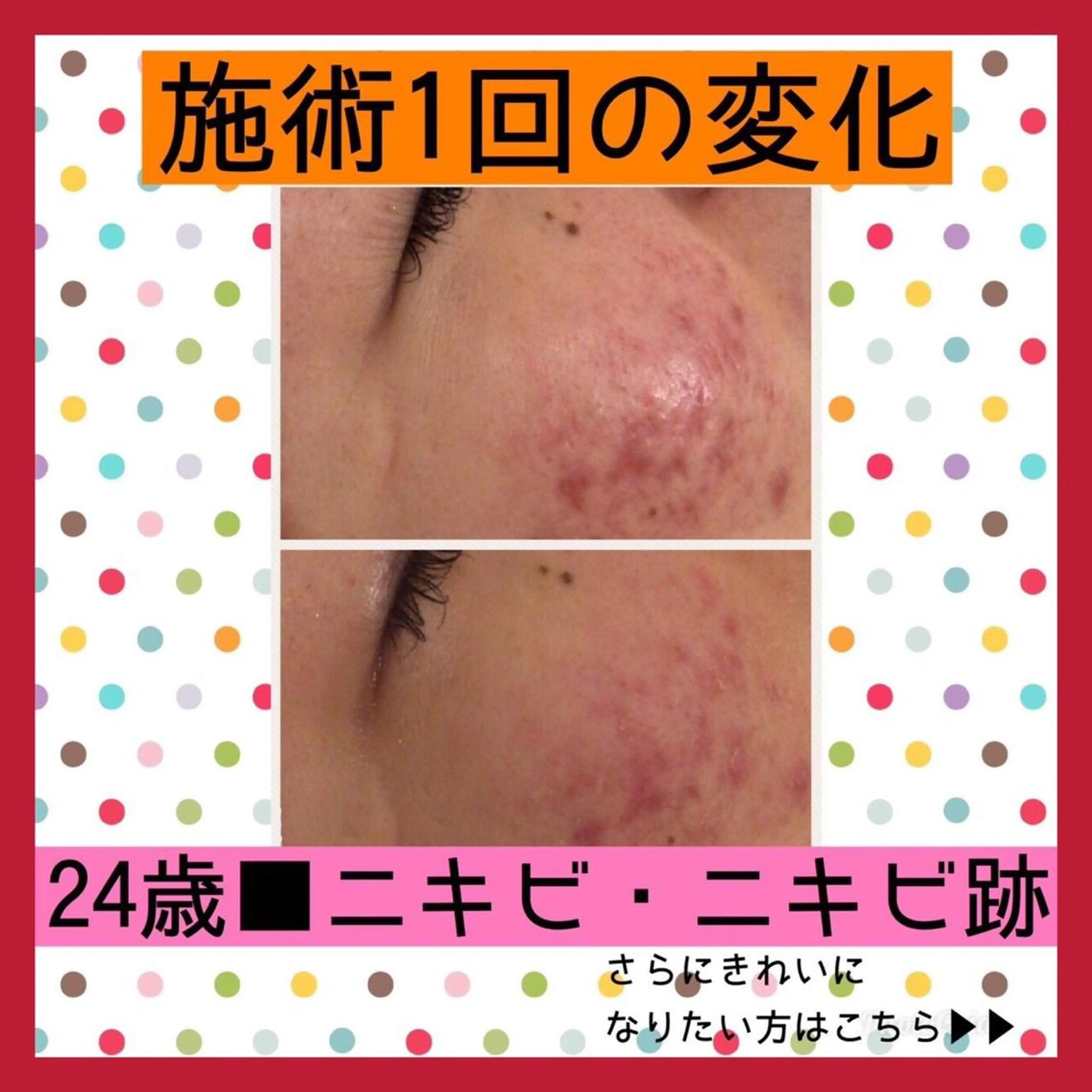 ミディアム カラー パーマ ヘアアレンジ メンズ キッズ ネイル マツエク・マツパ エステ リラク ニキビ・肌質改善専門 ♡人生が変わるサロンのエステ・リラクイメージ