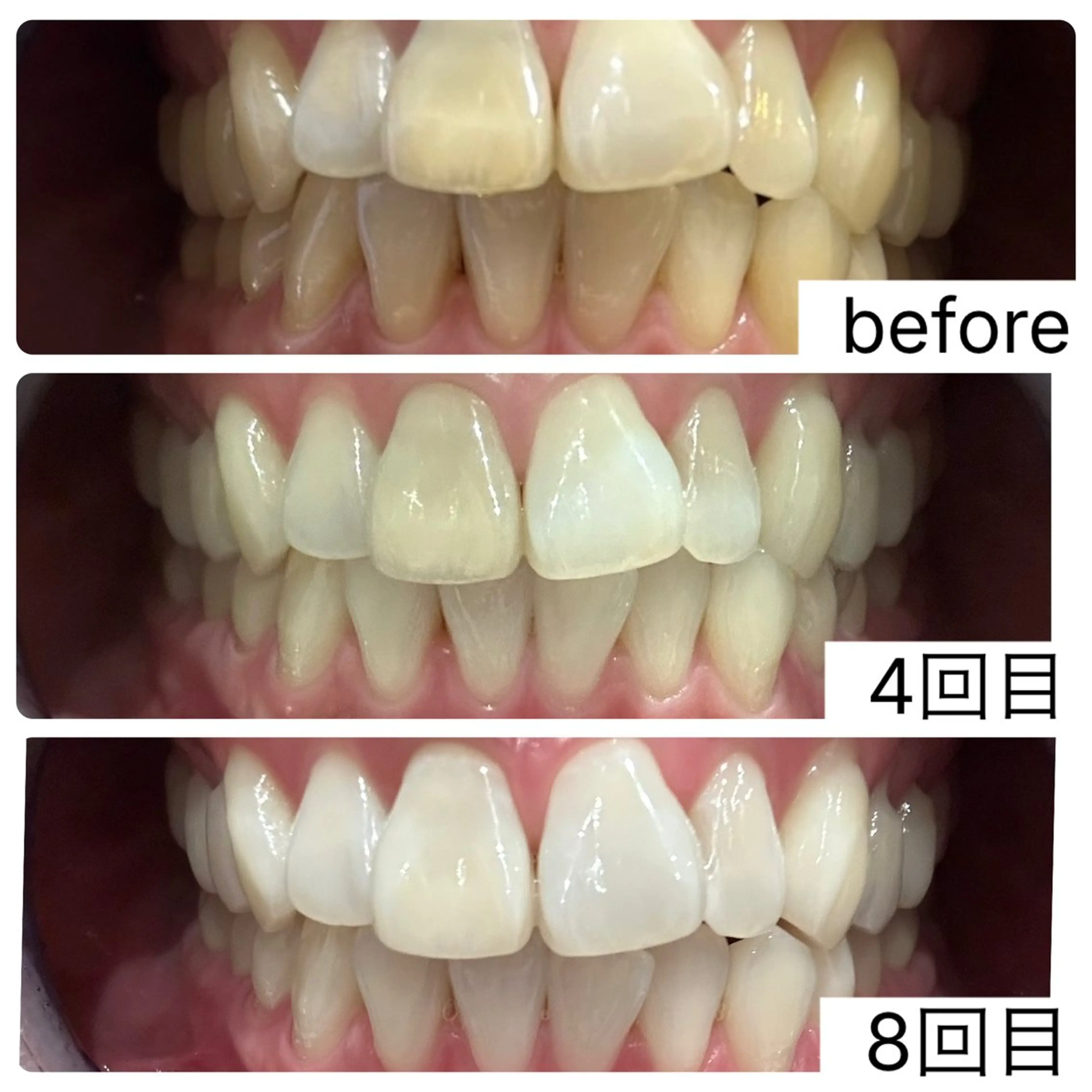 エステ The Salon 脱毛&眉毛の眉毛・アイブロウイメージ