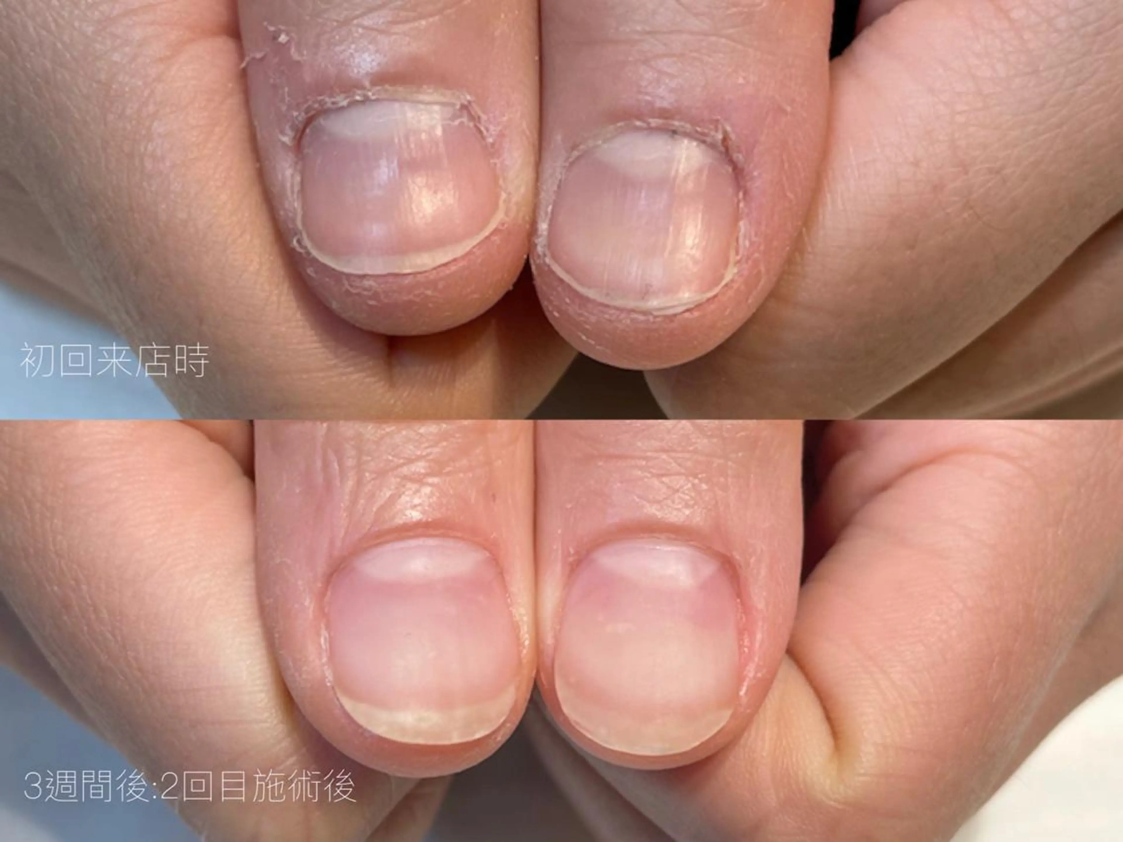 ネイル cachette mのネイルデザイン