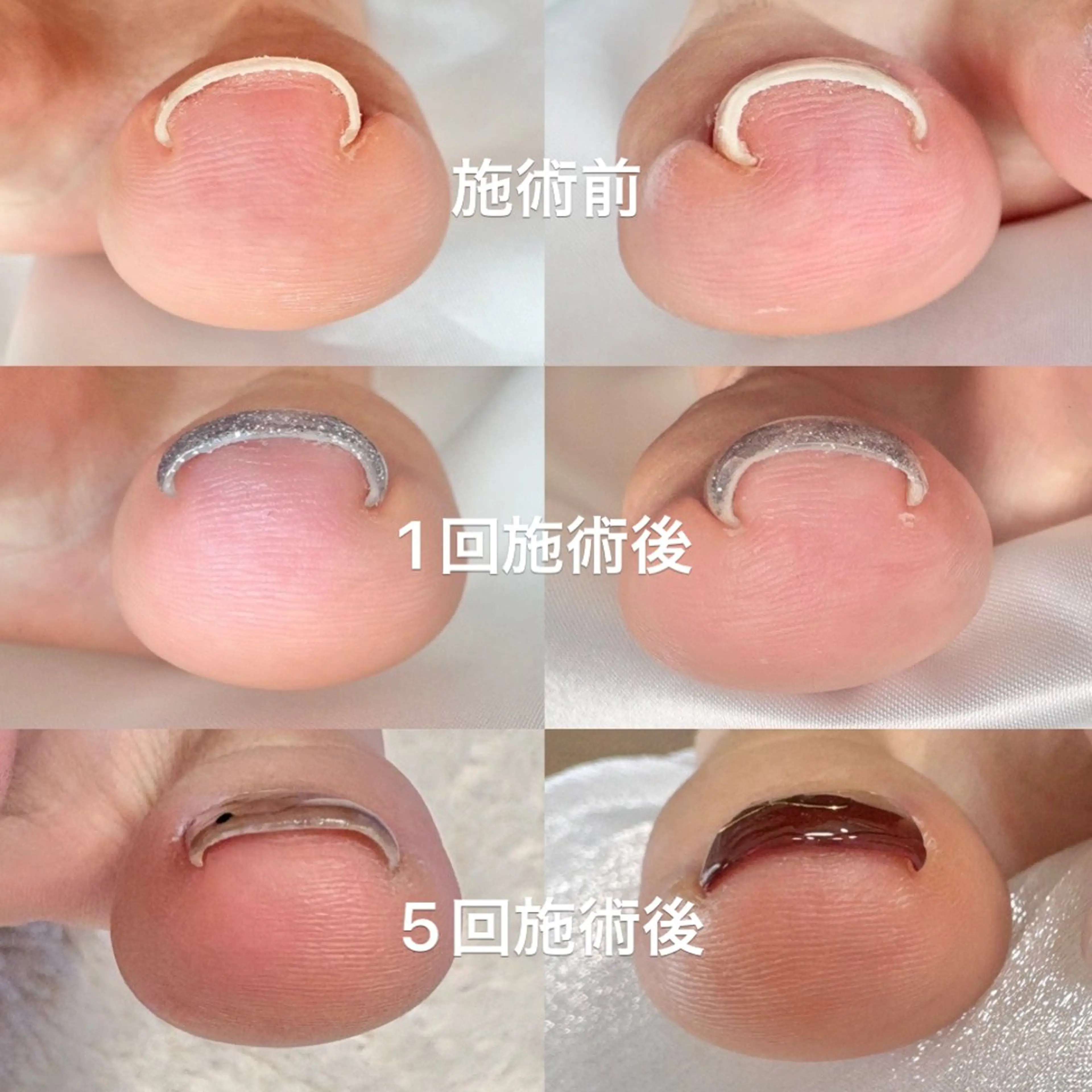 ネイル ジェルネイル フットネイル K Rのネイルデザイン