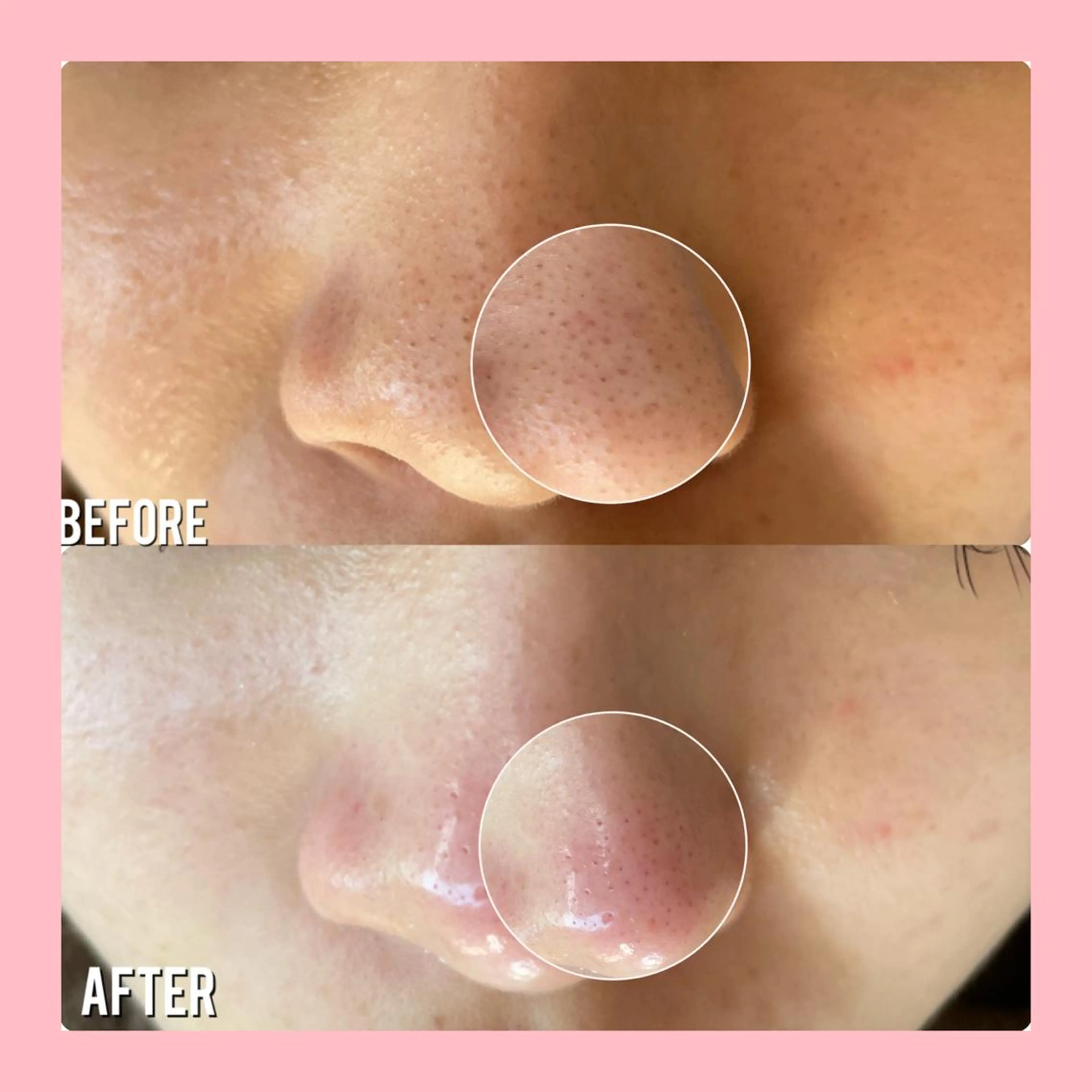 Mignon +所属・Mignon + Natsukiのマツエク・マツパデザイン