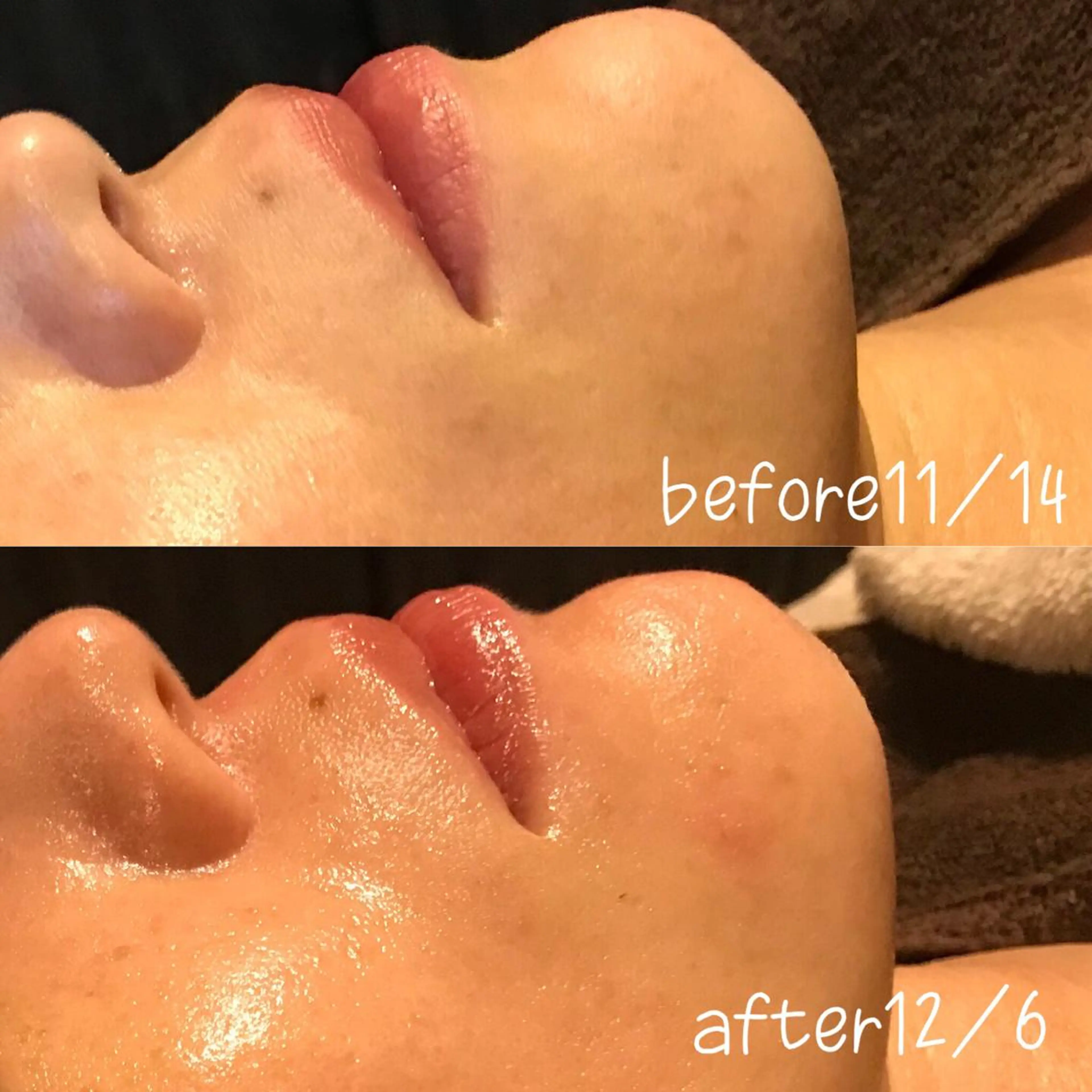 エステ 浜野 恵美のエステ・リラクイメージ