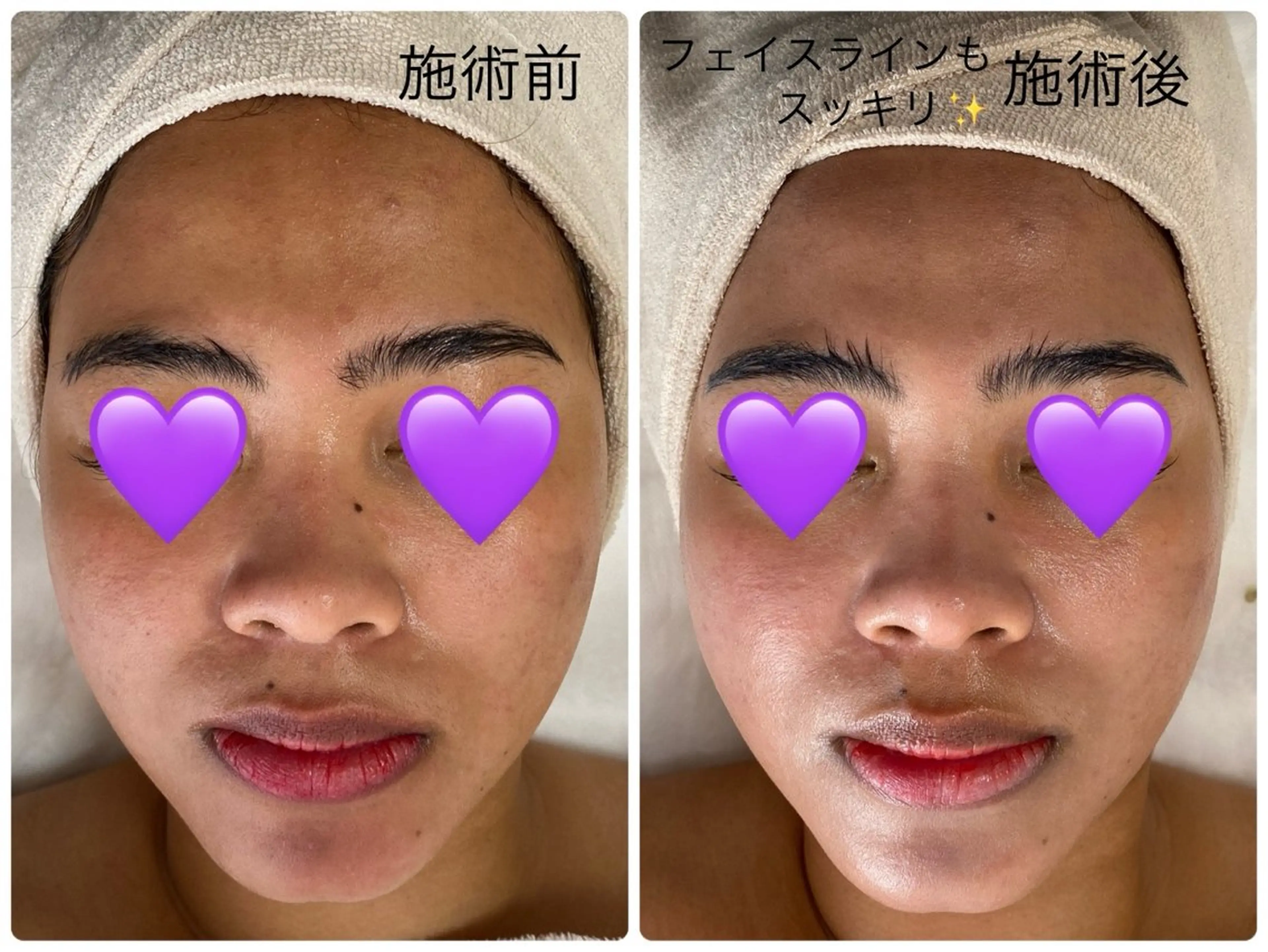 エステ COCO beautyサロンのエステ・リラクイメージ