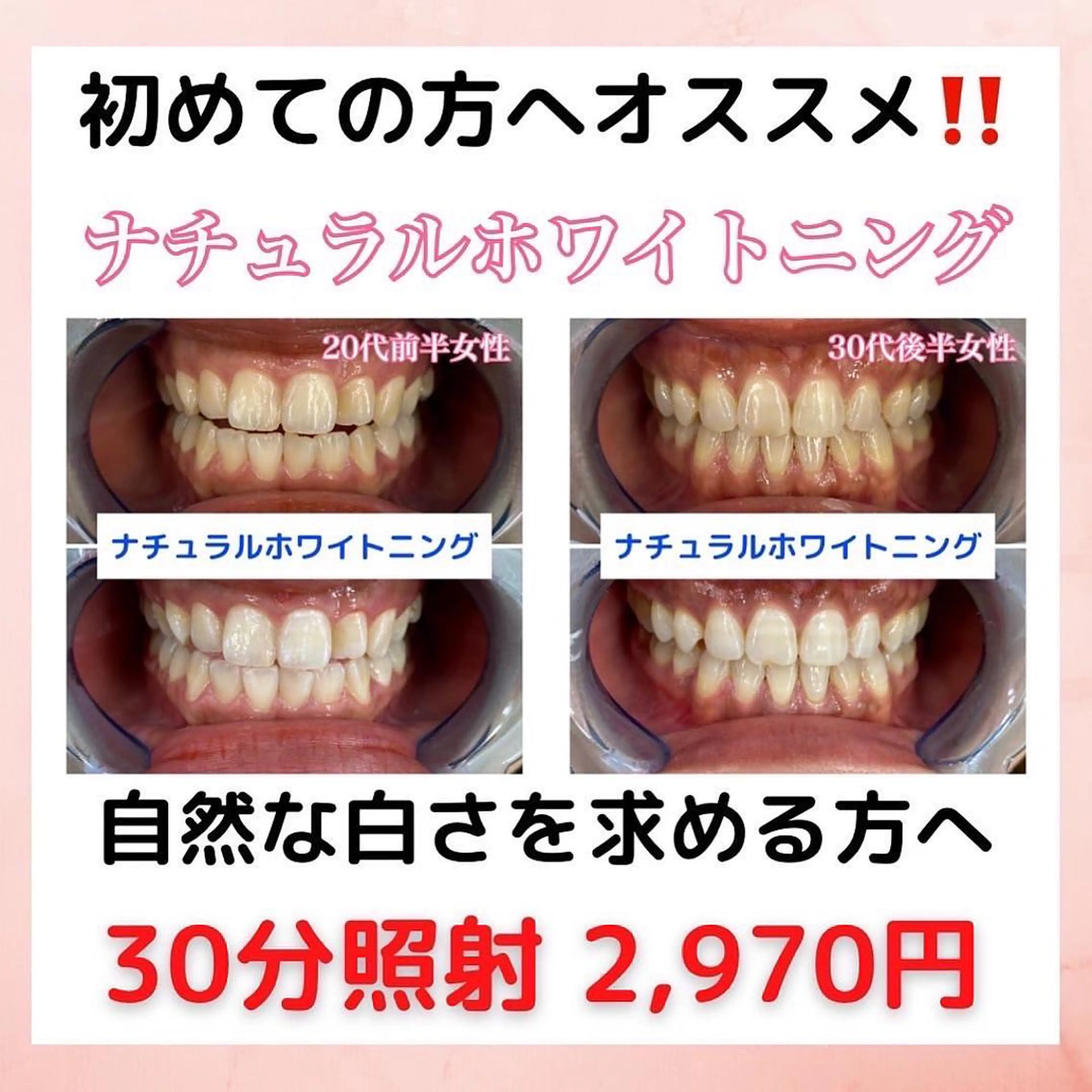 その他 吉田亮利 ホワイトニング専門店のその他イメージ