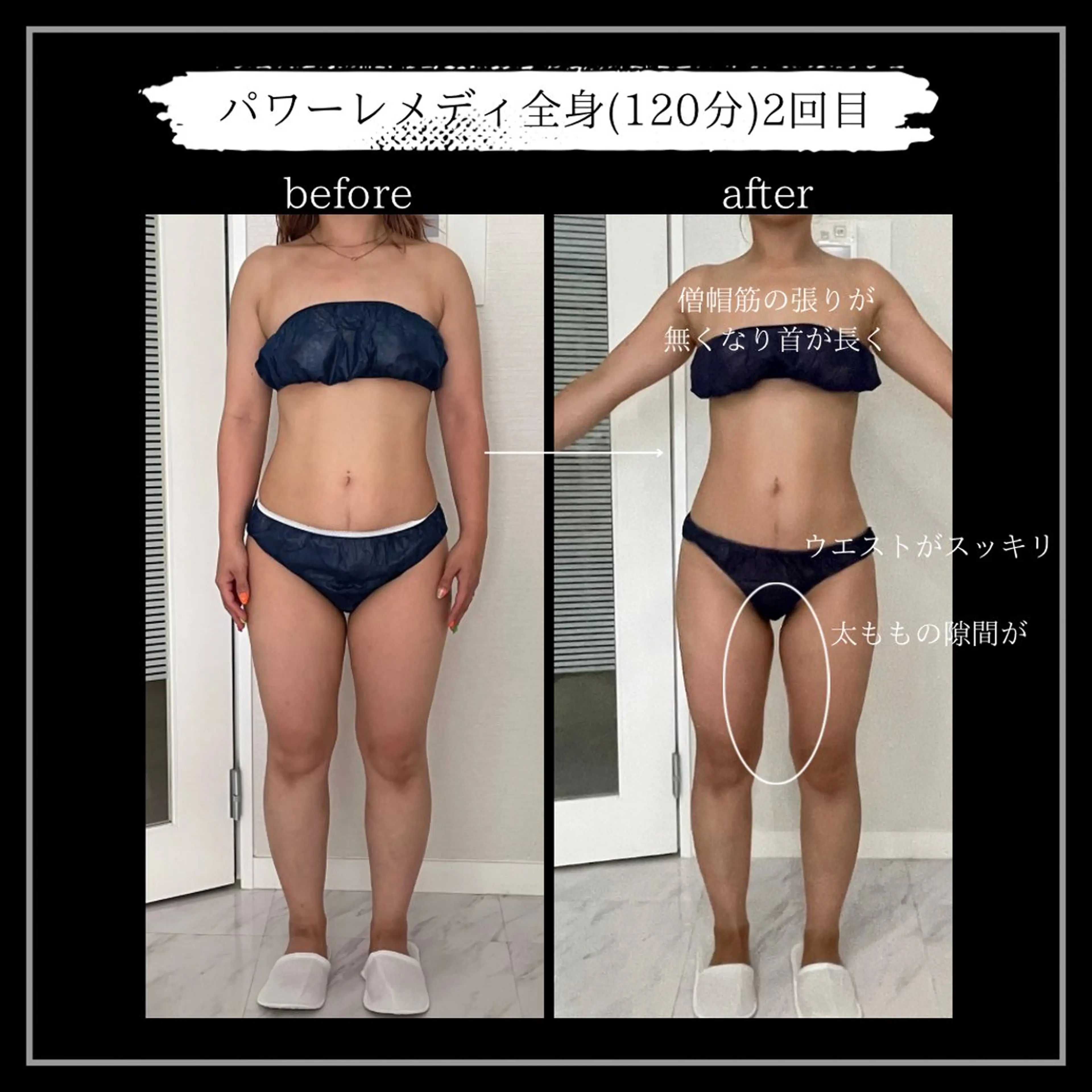 オフ:オン 全身筋膜マッサージのエステ・リラクイメージ