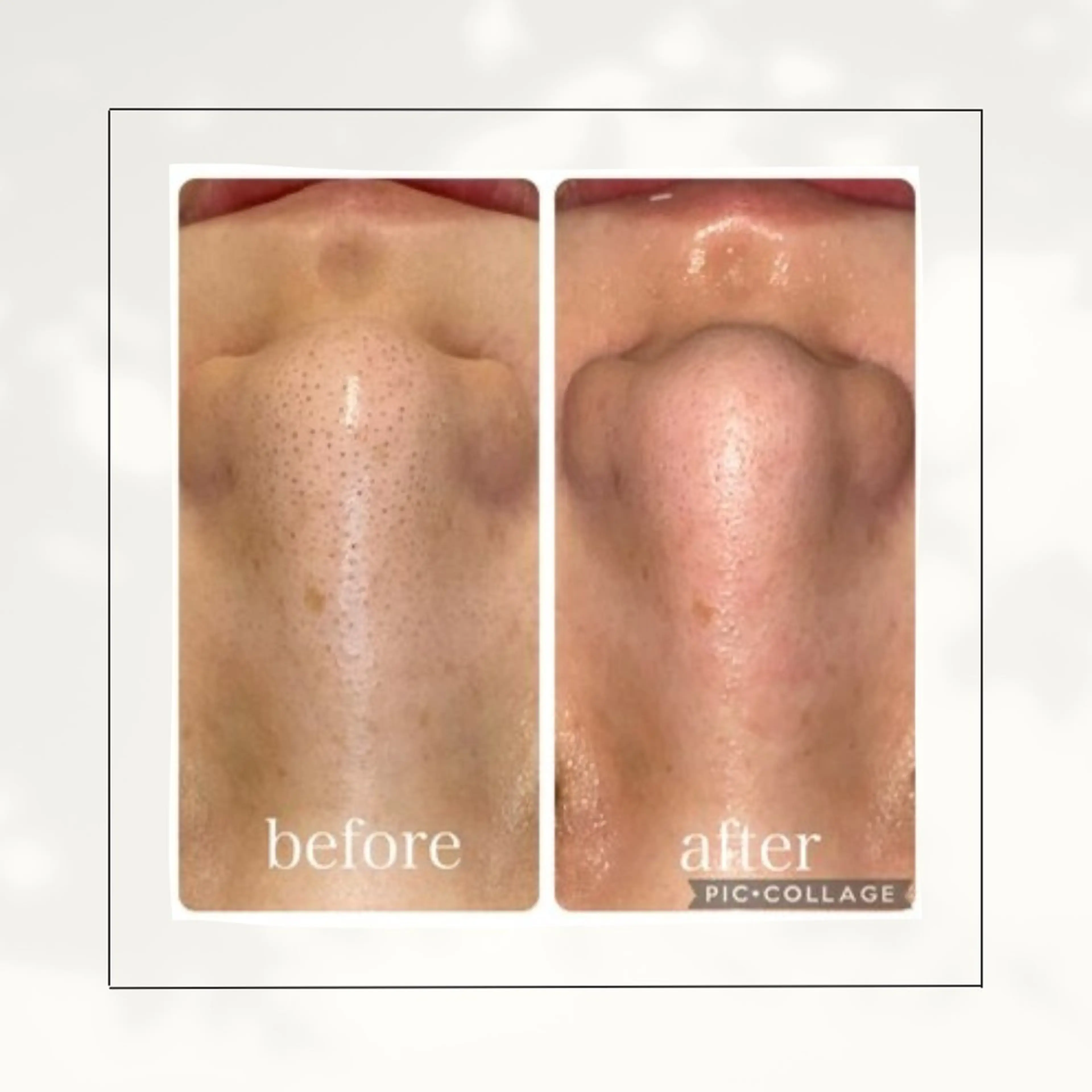 エステ シミ・毛穴専門店 /gracia 安藤のエステ・リラクイメージ