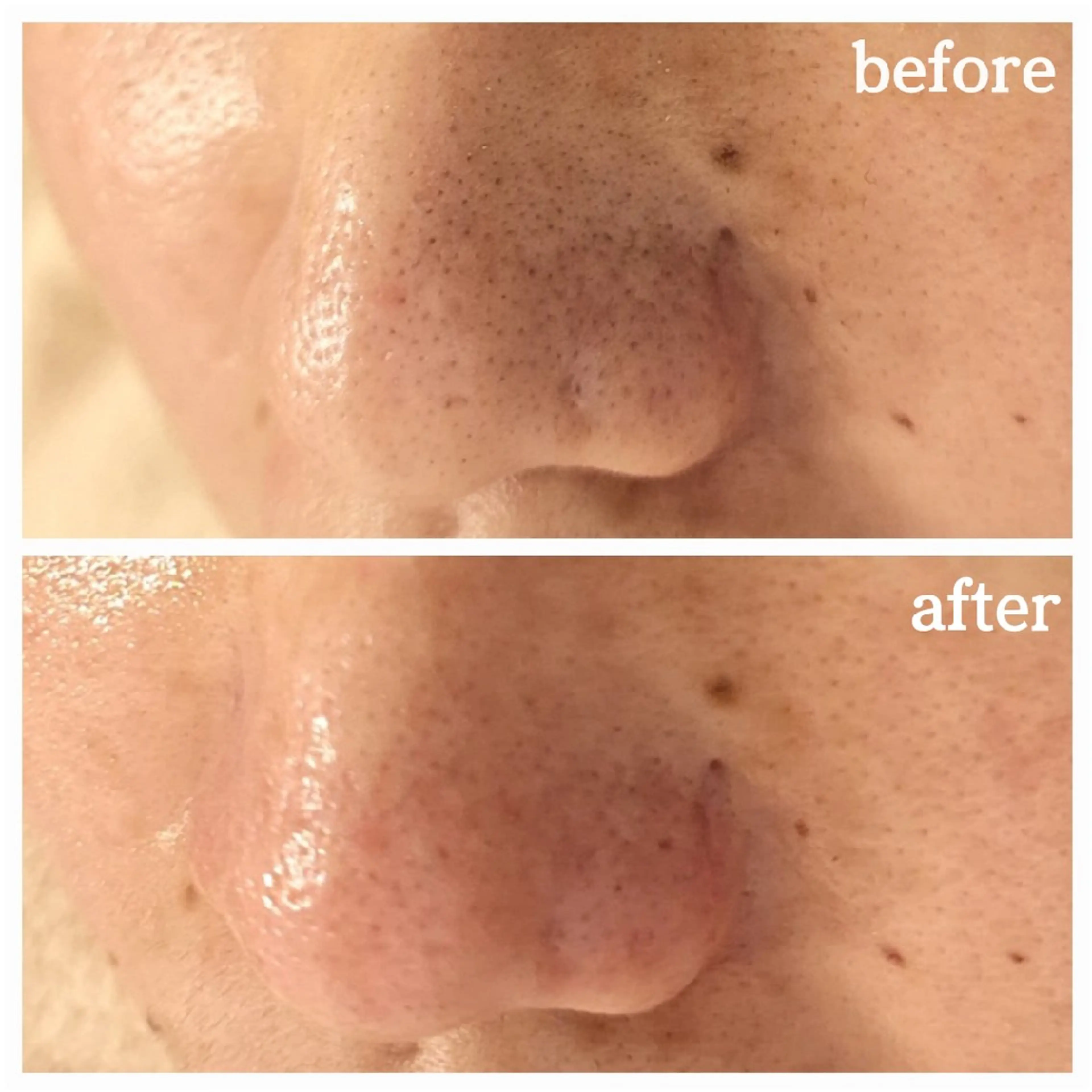 エステ フェイシャル専門サロ ン ERINのエステ・リラクイメージ