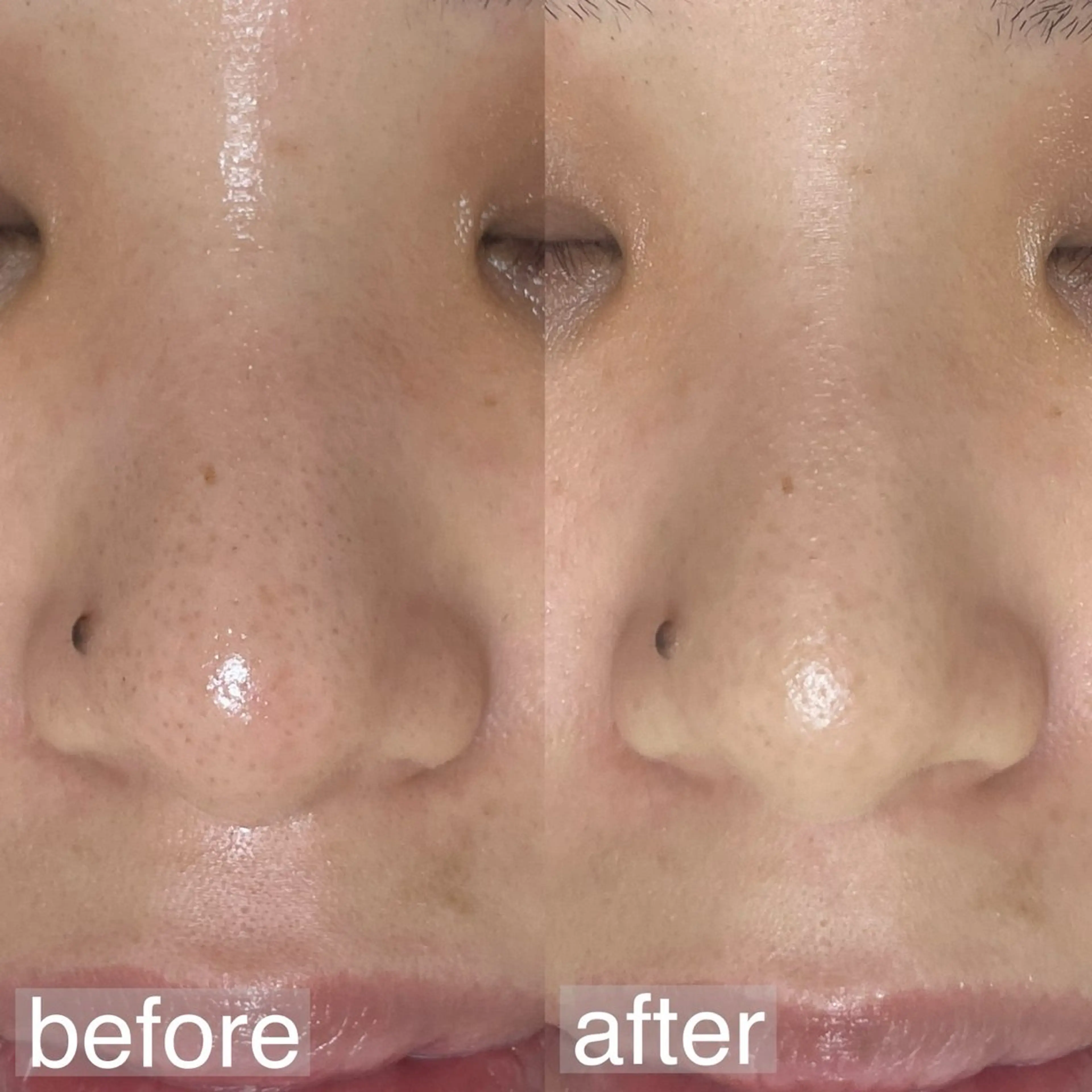 エステ アイブロウ&フェイシャルサロンa‘lm所属・WAX脱毛/肌質改善 眉毛とお肌のサロンのエステ・リラクイメージ