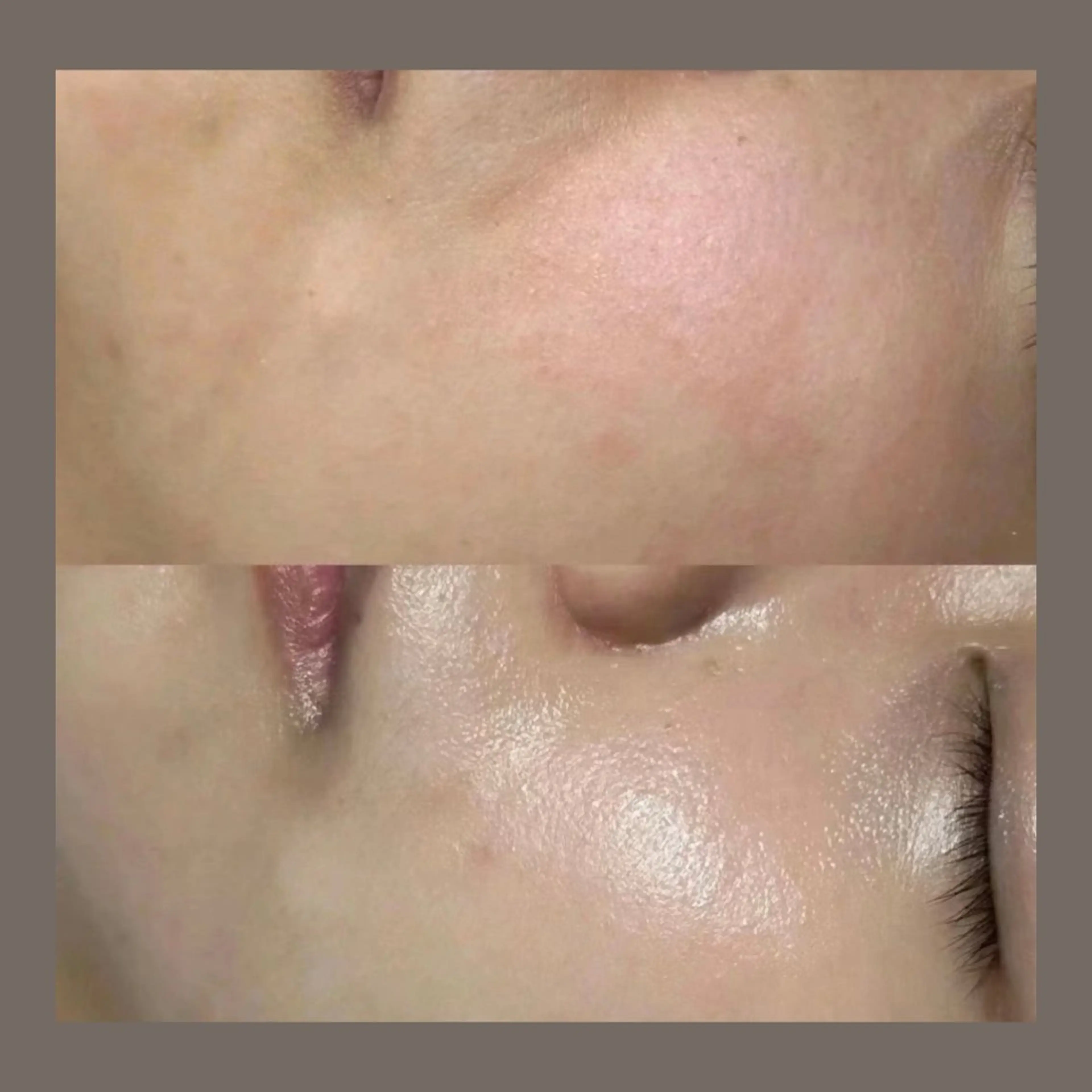 エステ リラク 愛維美水光美肌専門店所属・愛維美水光美肌専門店 メンズレディースokのエステ・リラクイメージ