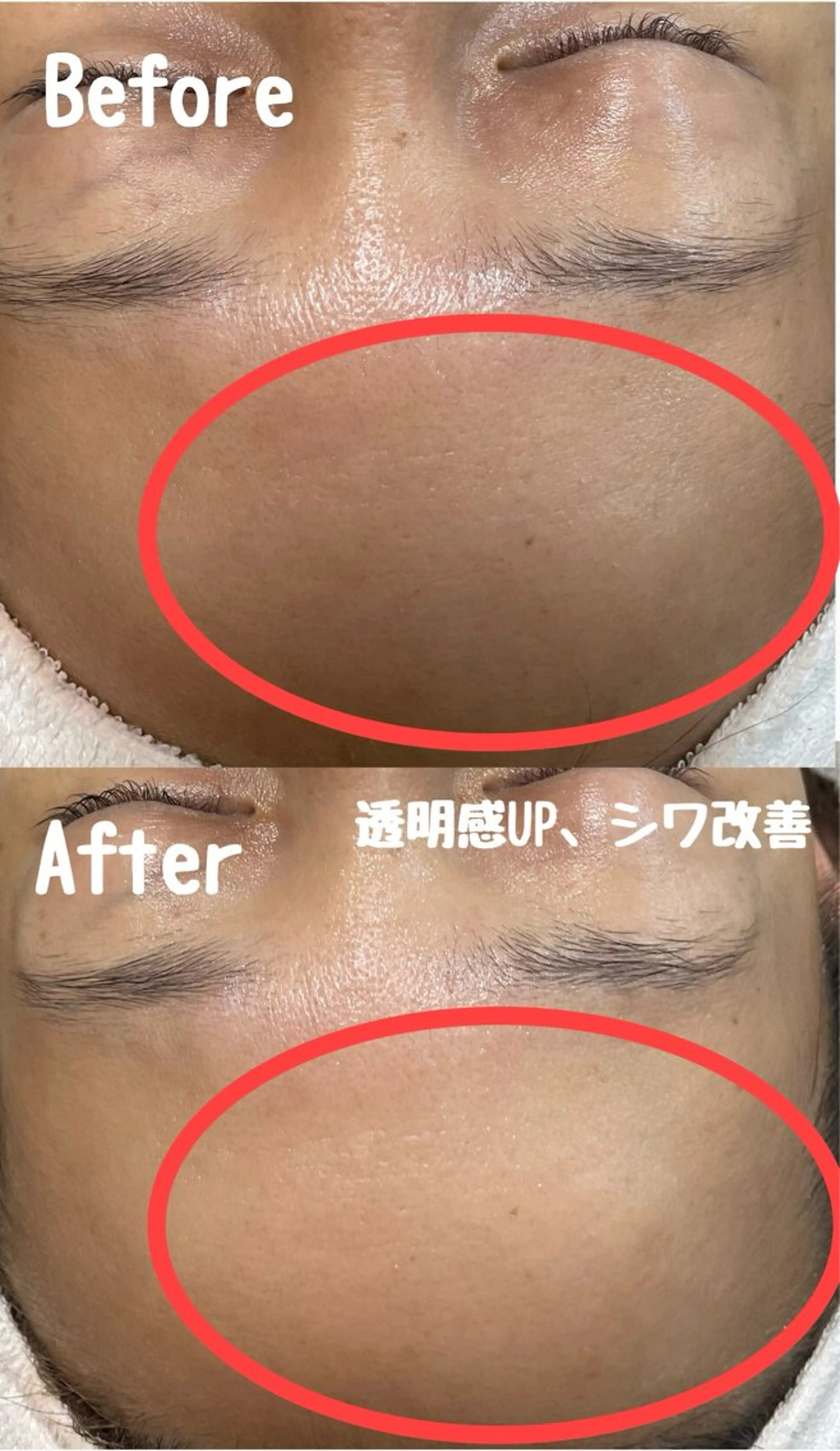 エステ リラク Surien 水脇ゆうのその他イメージ